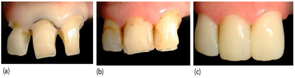 Materials 08 00717 g003 1024