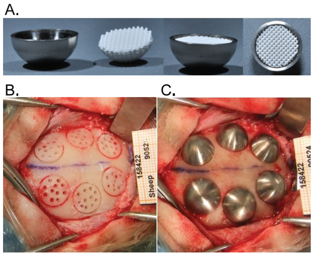 Materials 08 02174 g001 1024