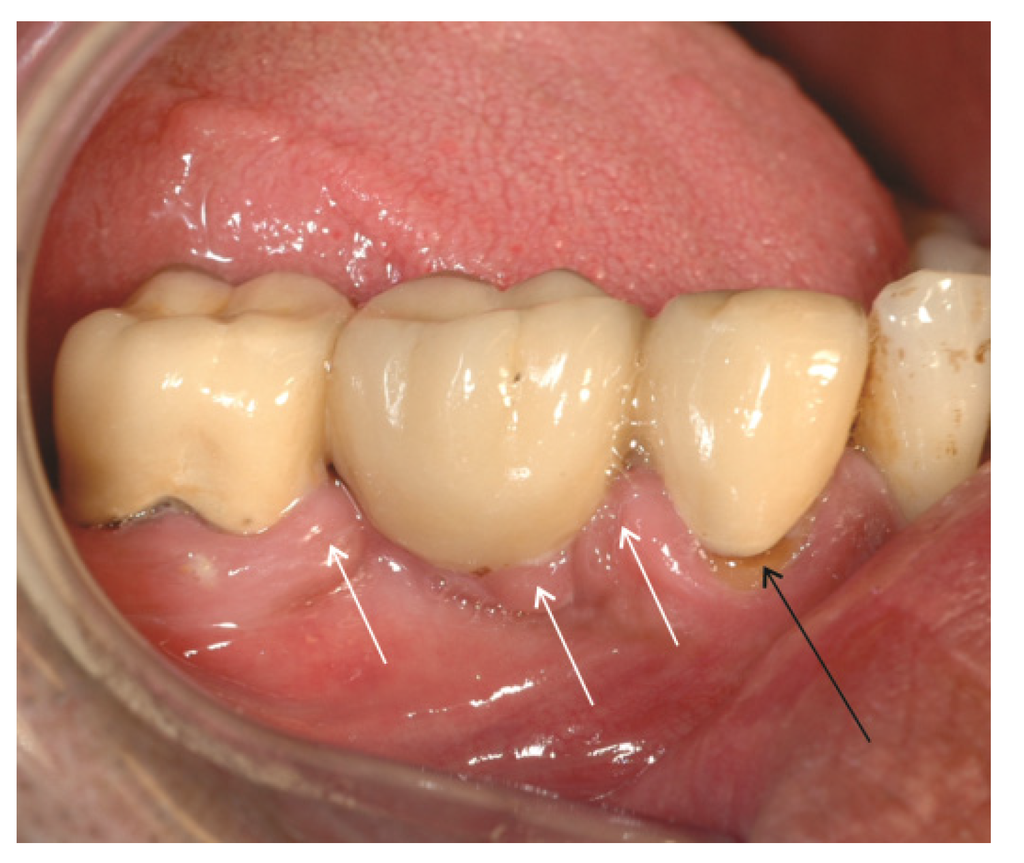 Materials 08 02887 g004 1024