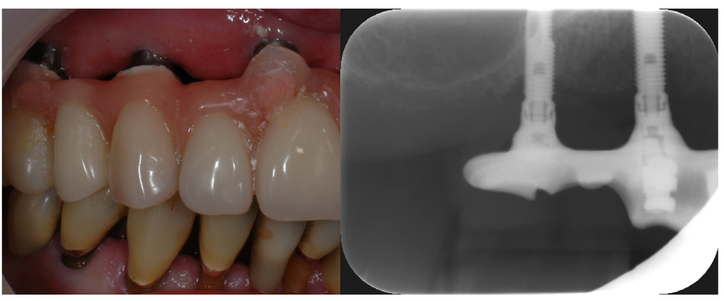 Materials 08 02887 g006 1024