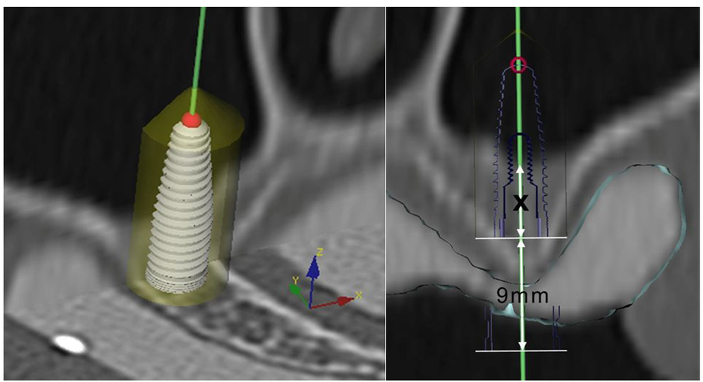 Materials 08 03210 g001 1024