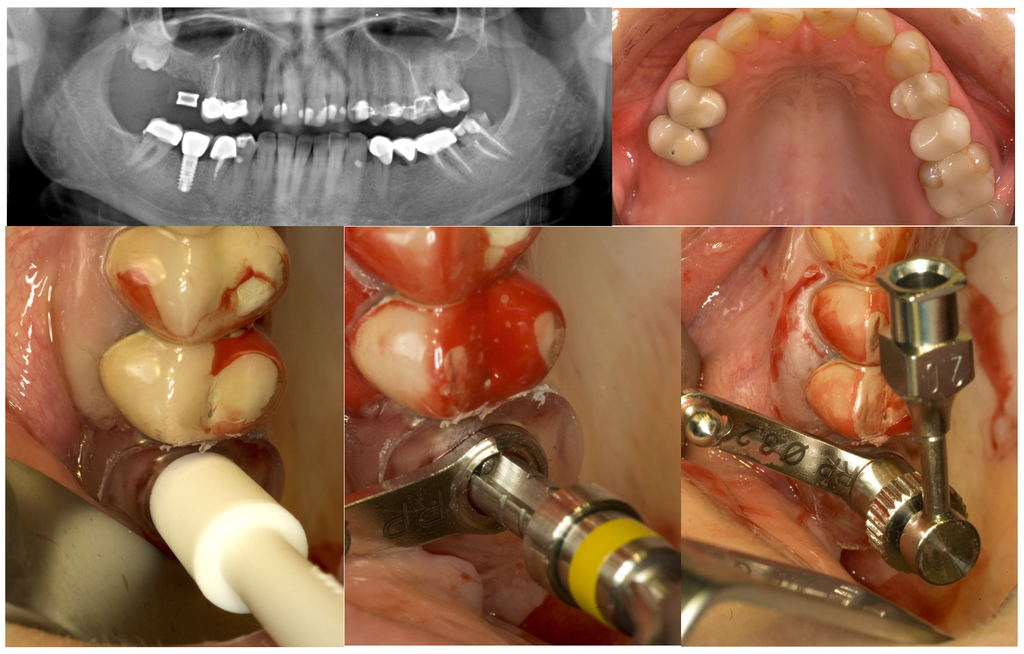 Materials 08 03210 g002a 1024