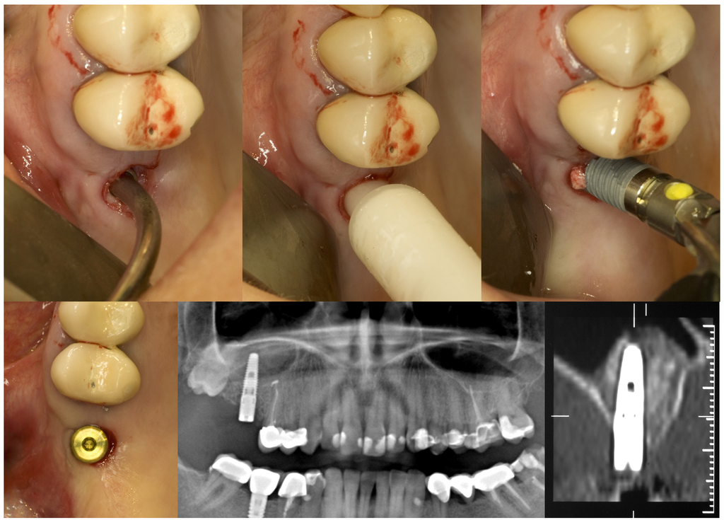 Materials 08 03210 g002b 1024