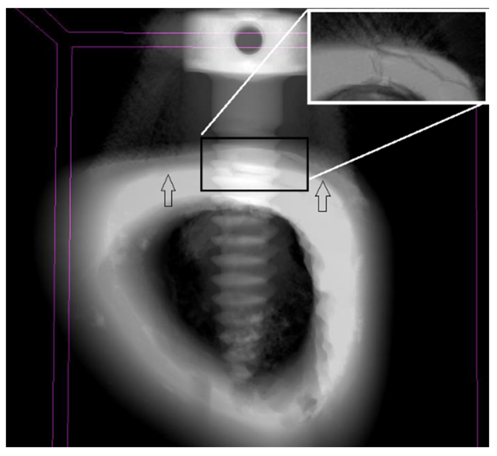 Materials 08 05322 g006 1024