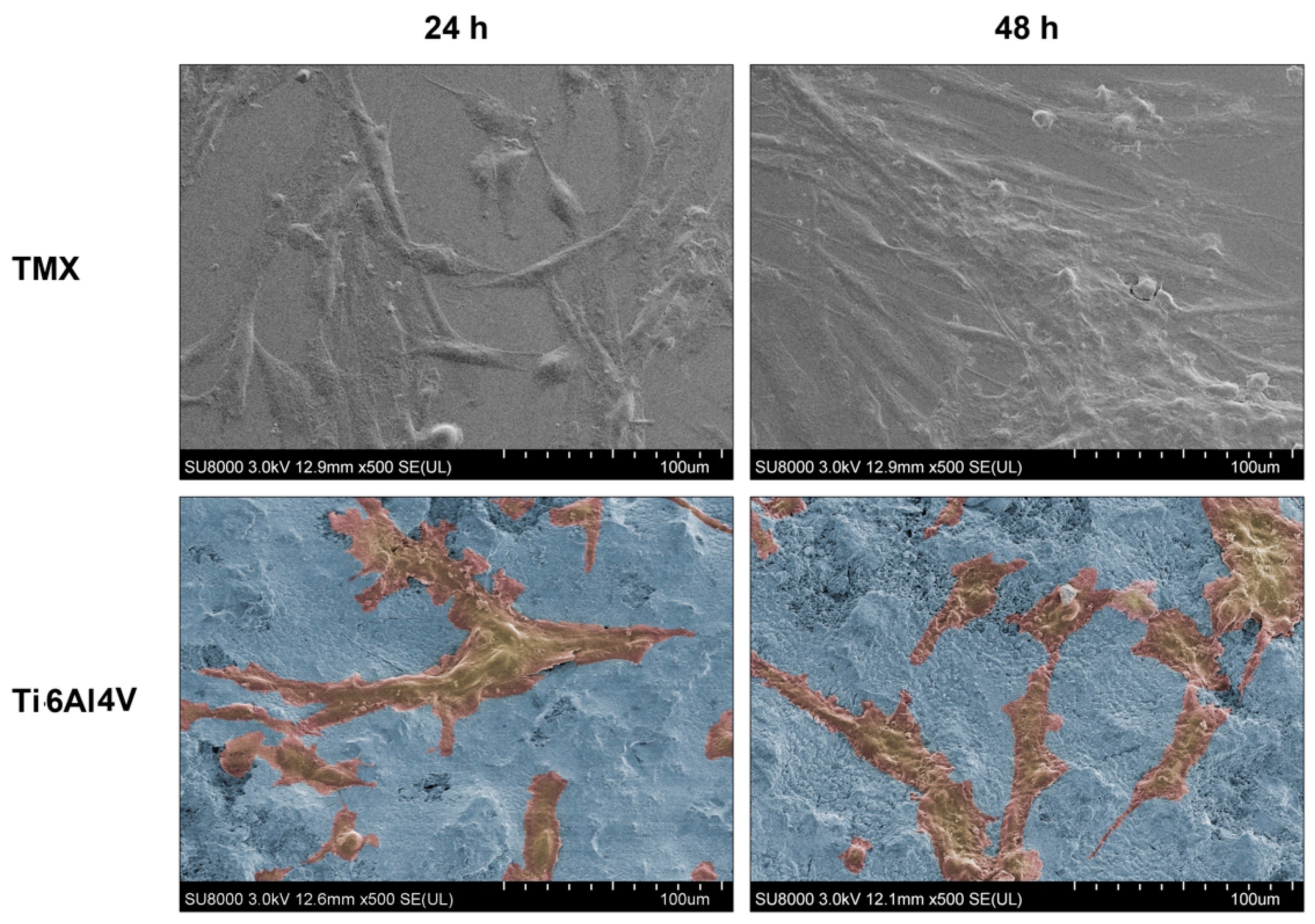 Materials 10 00094 g013