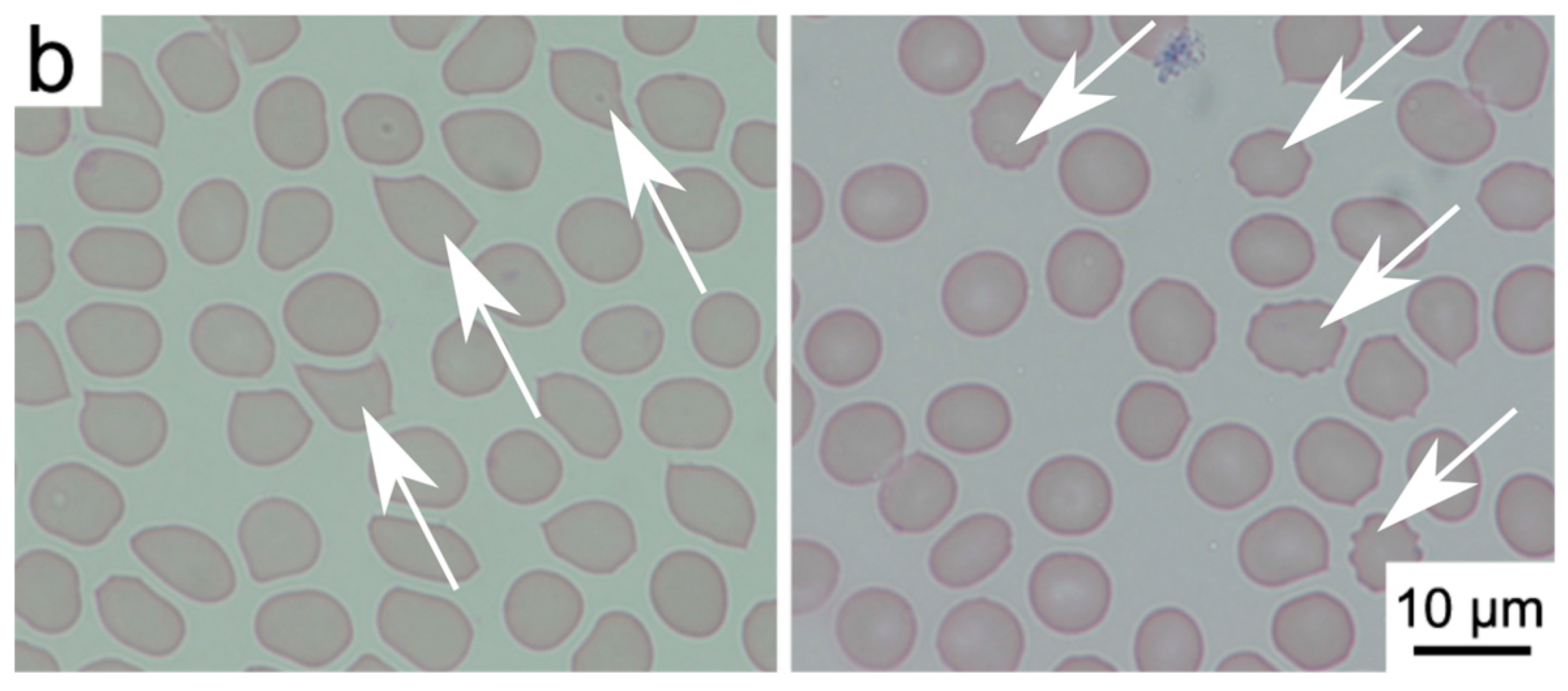 Materials 10 00352 g004b