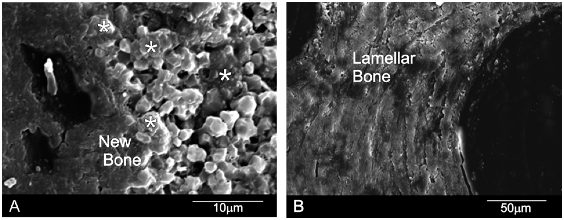 Materials 10 00542 g004