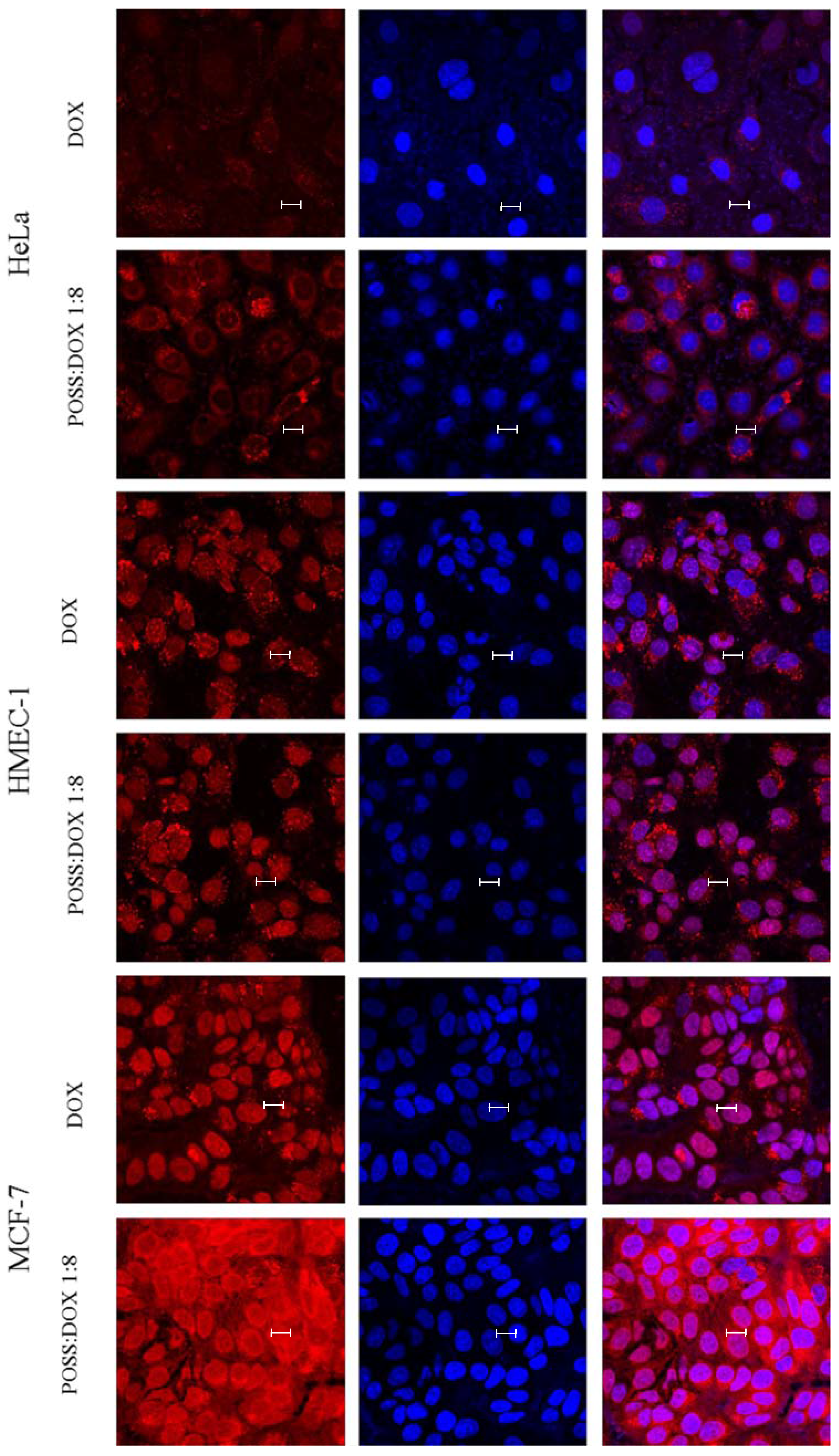 Materials 10 00559 g004