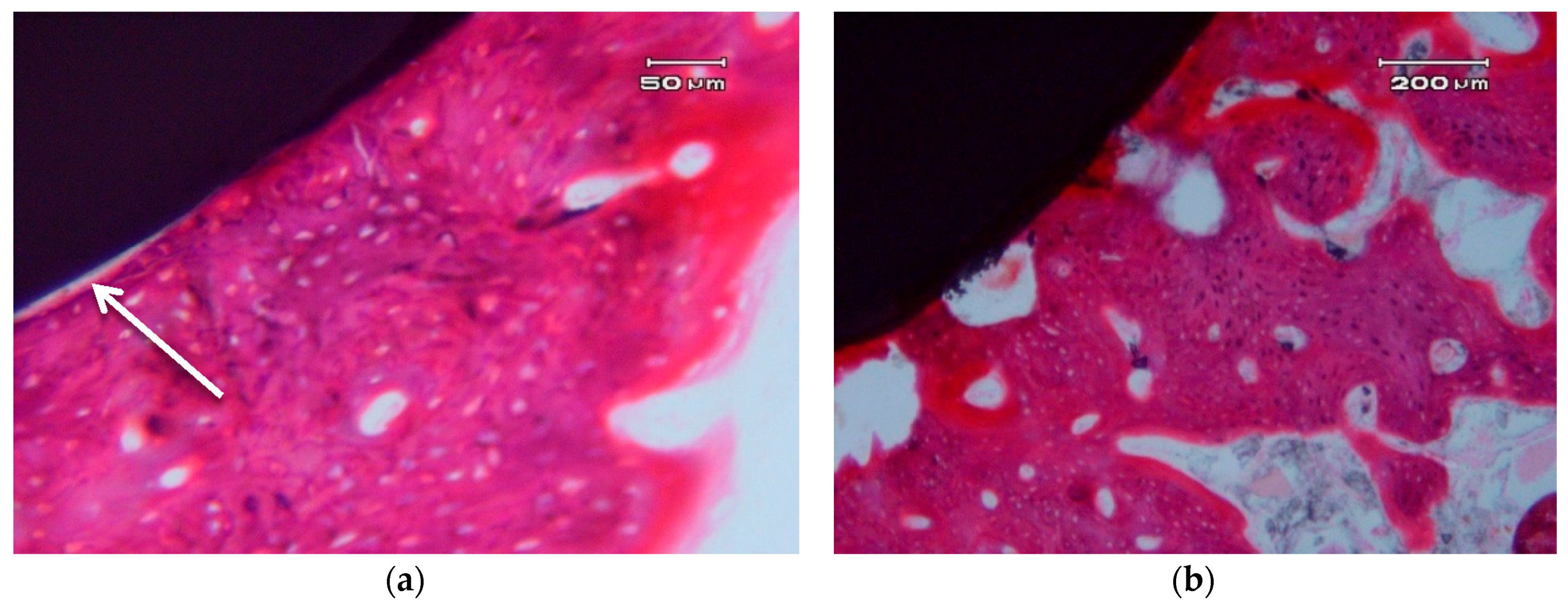 Materials 10 00614 g005