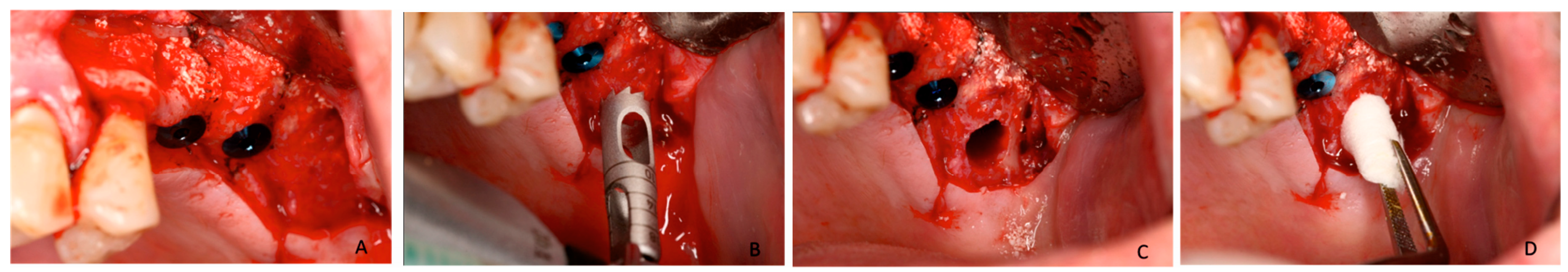 Materials 10 00623 g010