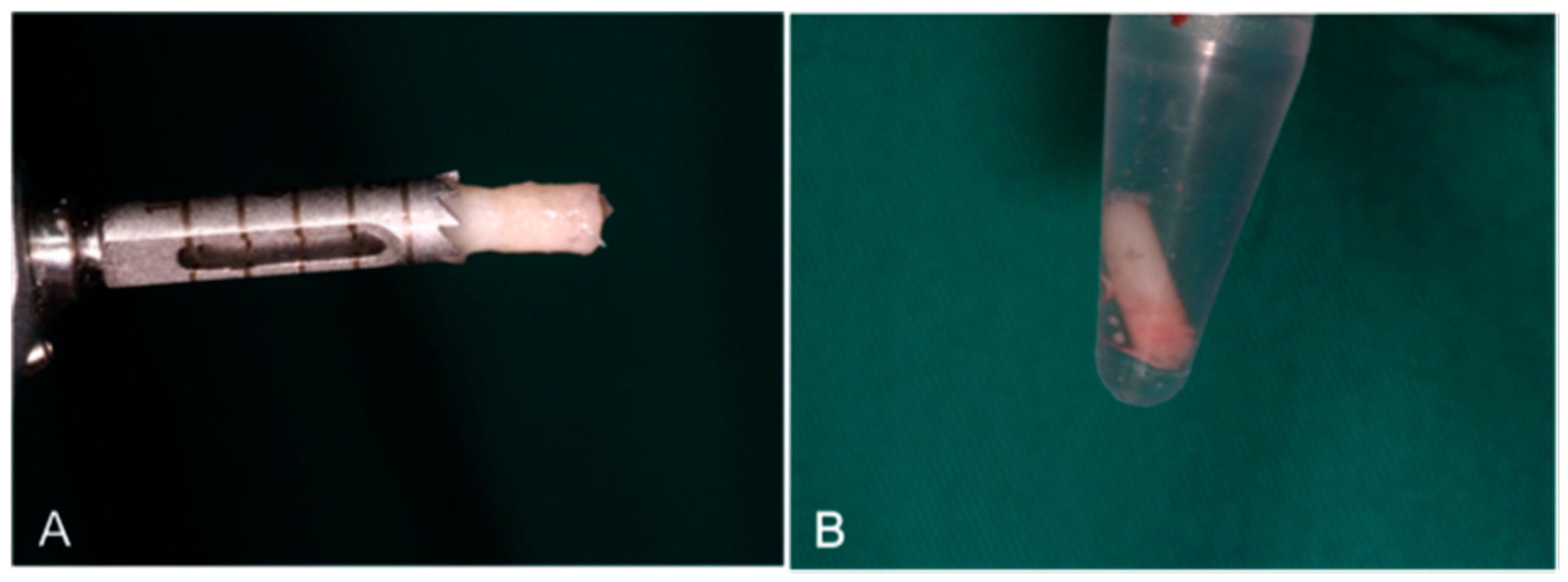 Materials 10 00623 g011