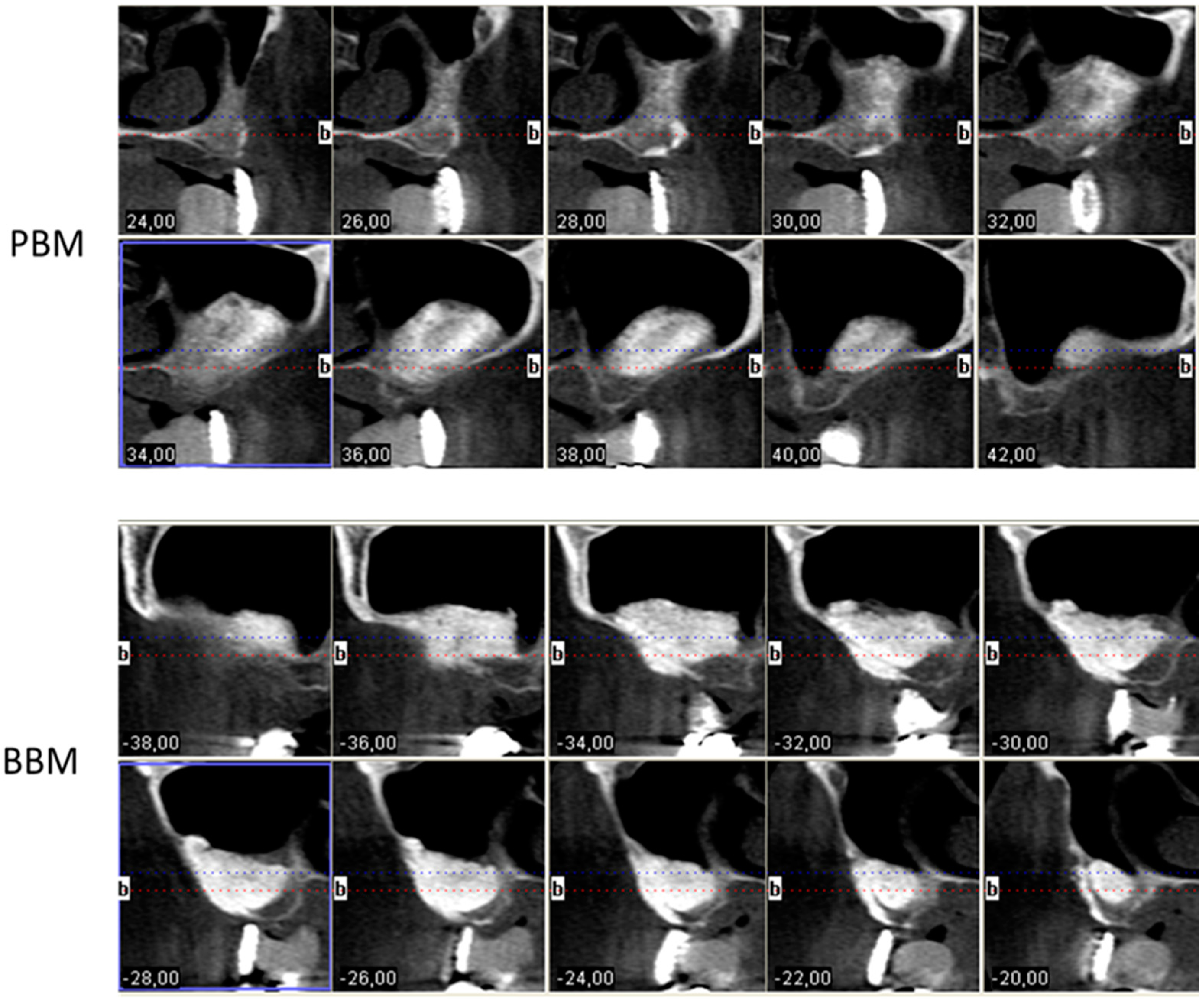 Materials 10 00644 g002