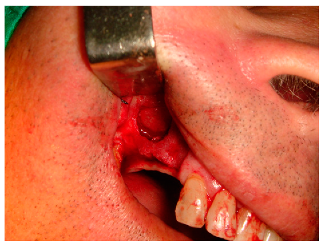 Materials 10 00644 g005