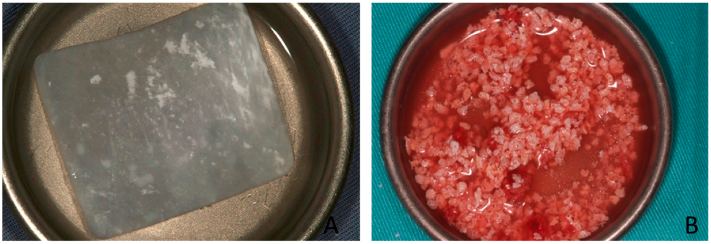 Materials 10 00644 g006