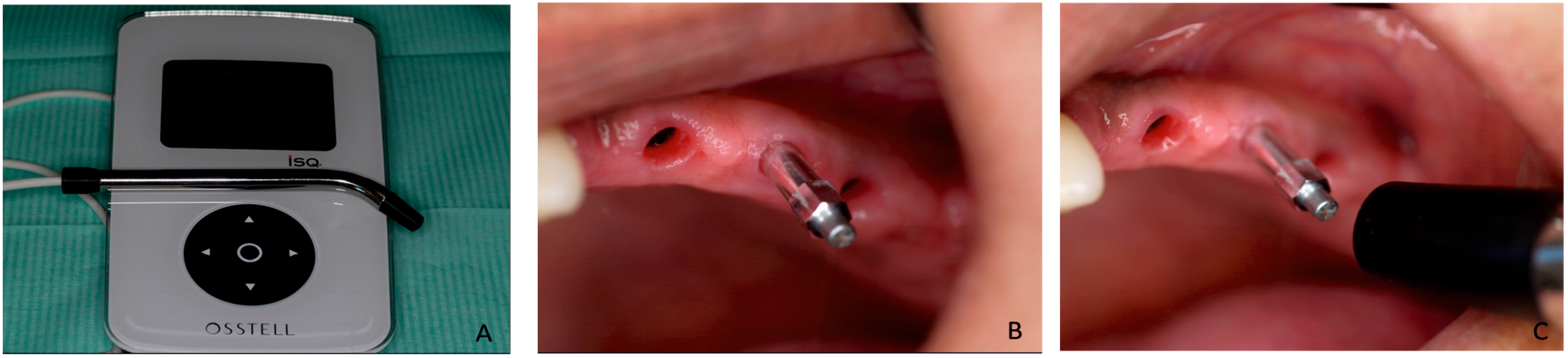 Materials 10 00644 g008