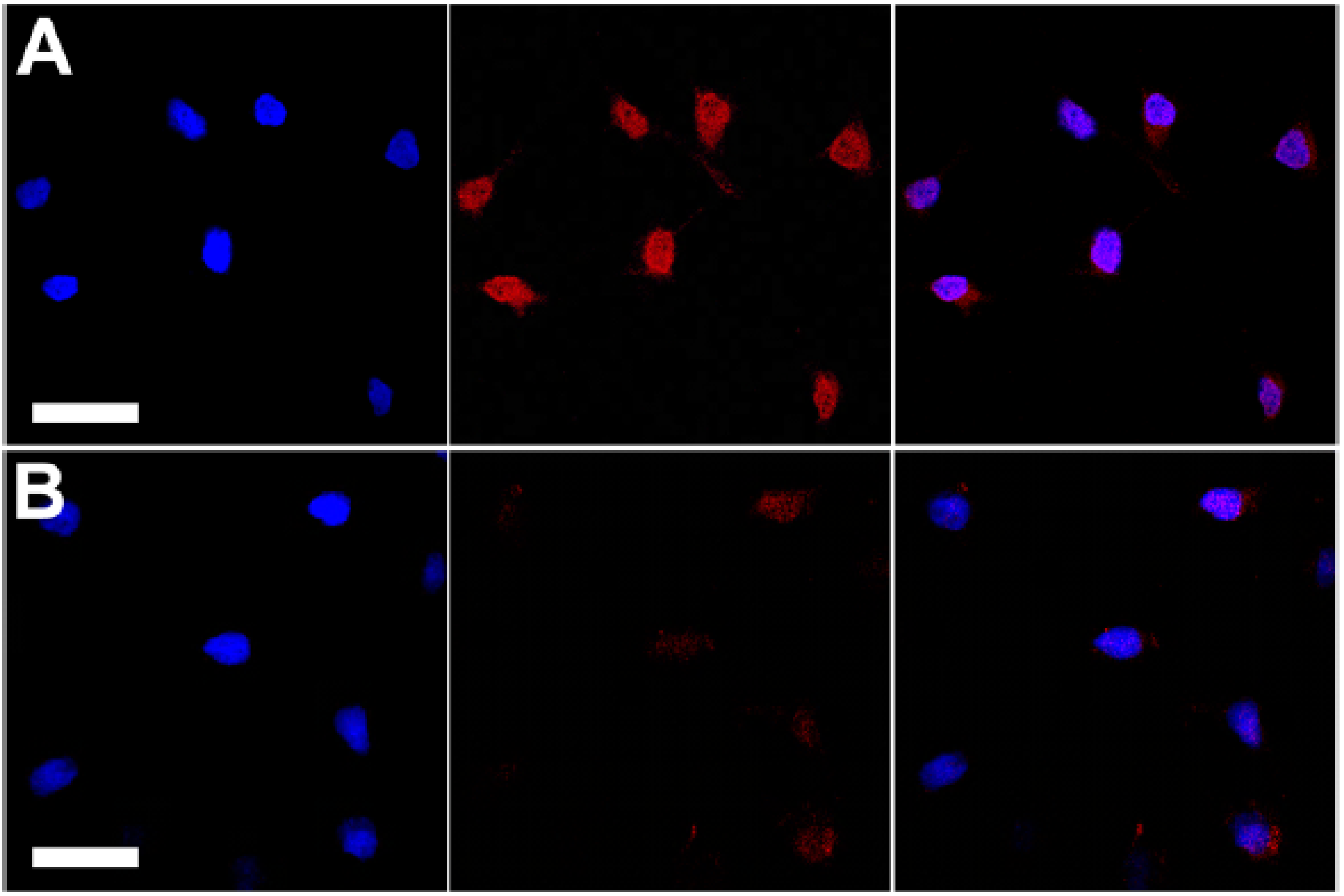 Materials 10 01420 g007