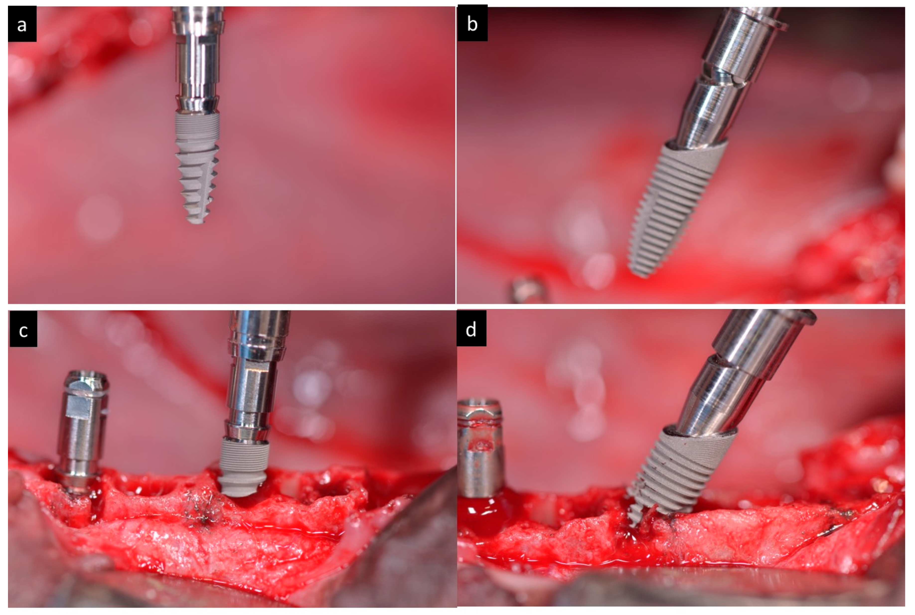 Materials 11 00119 g003
