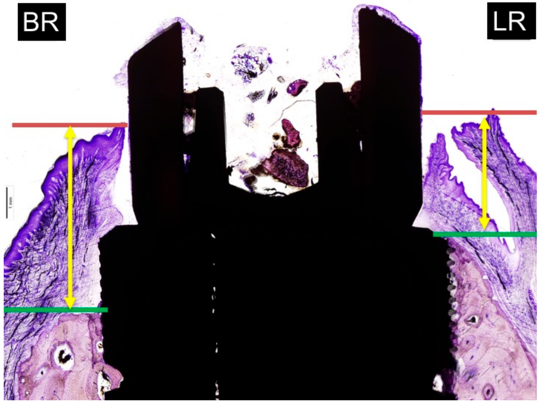 Materials 11 00119 g006