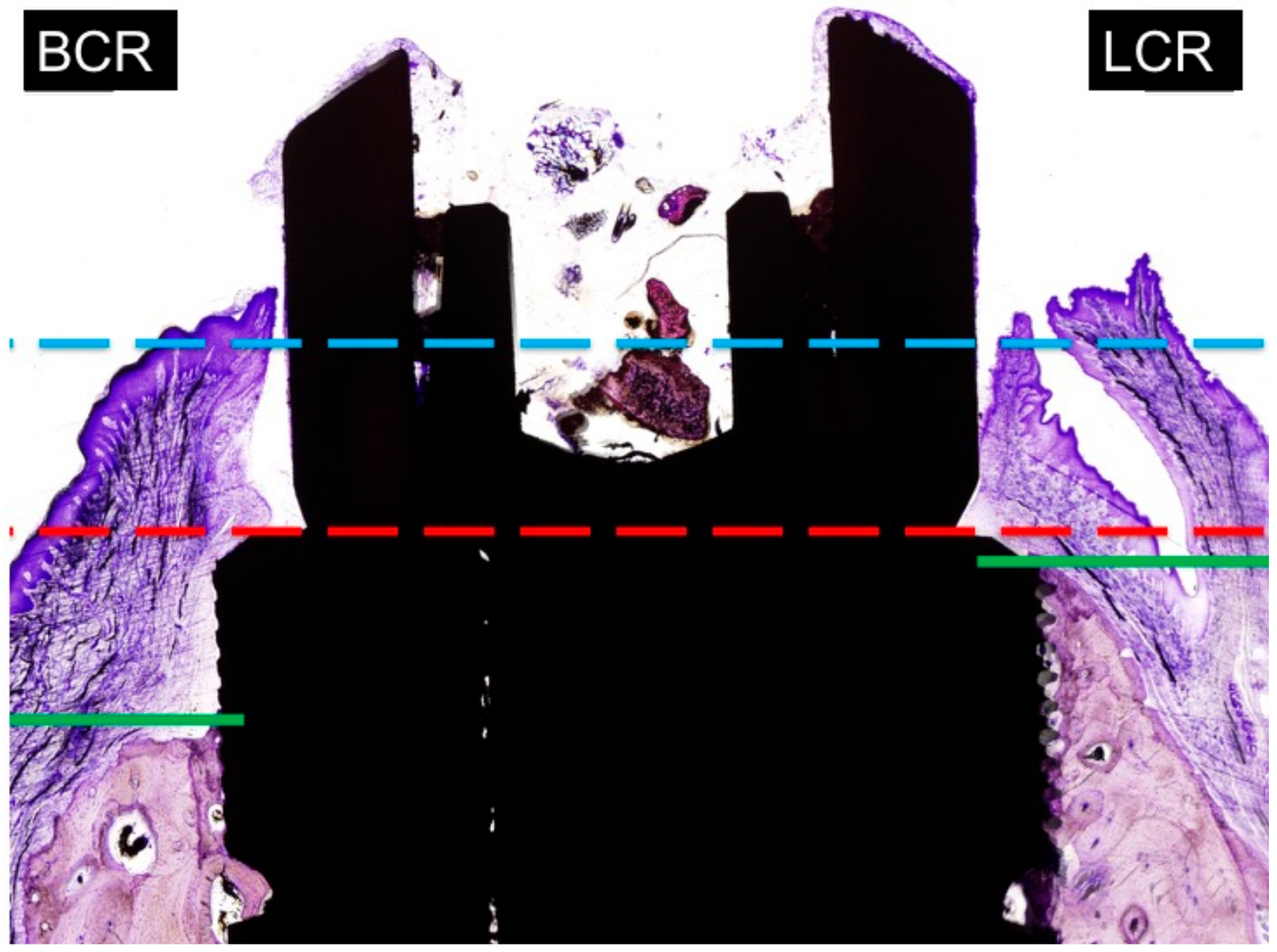 Materials 11 00119 g007