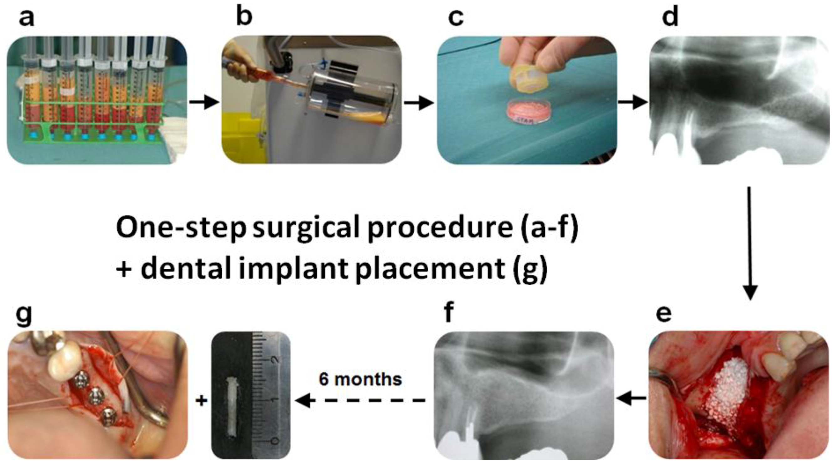 Materials 11 00161 g001