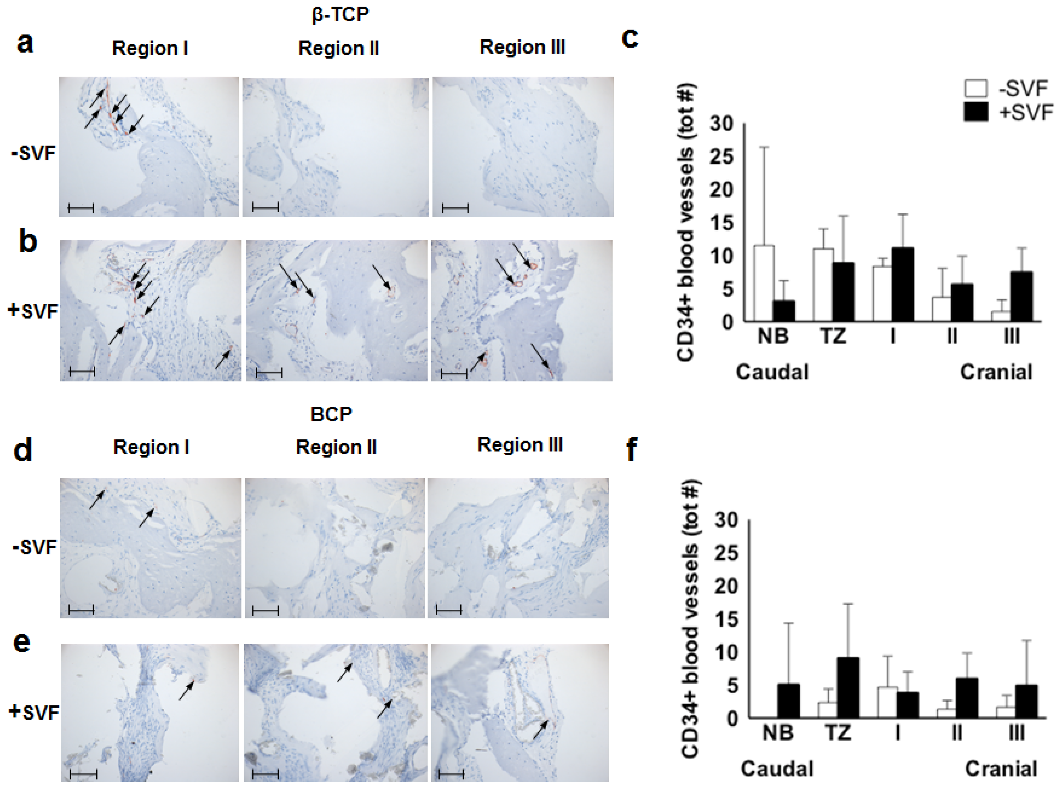 Materials 11 00161 g003
