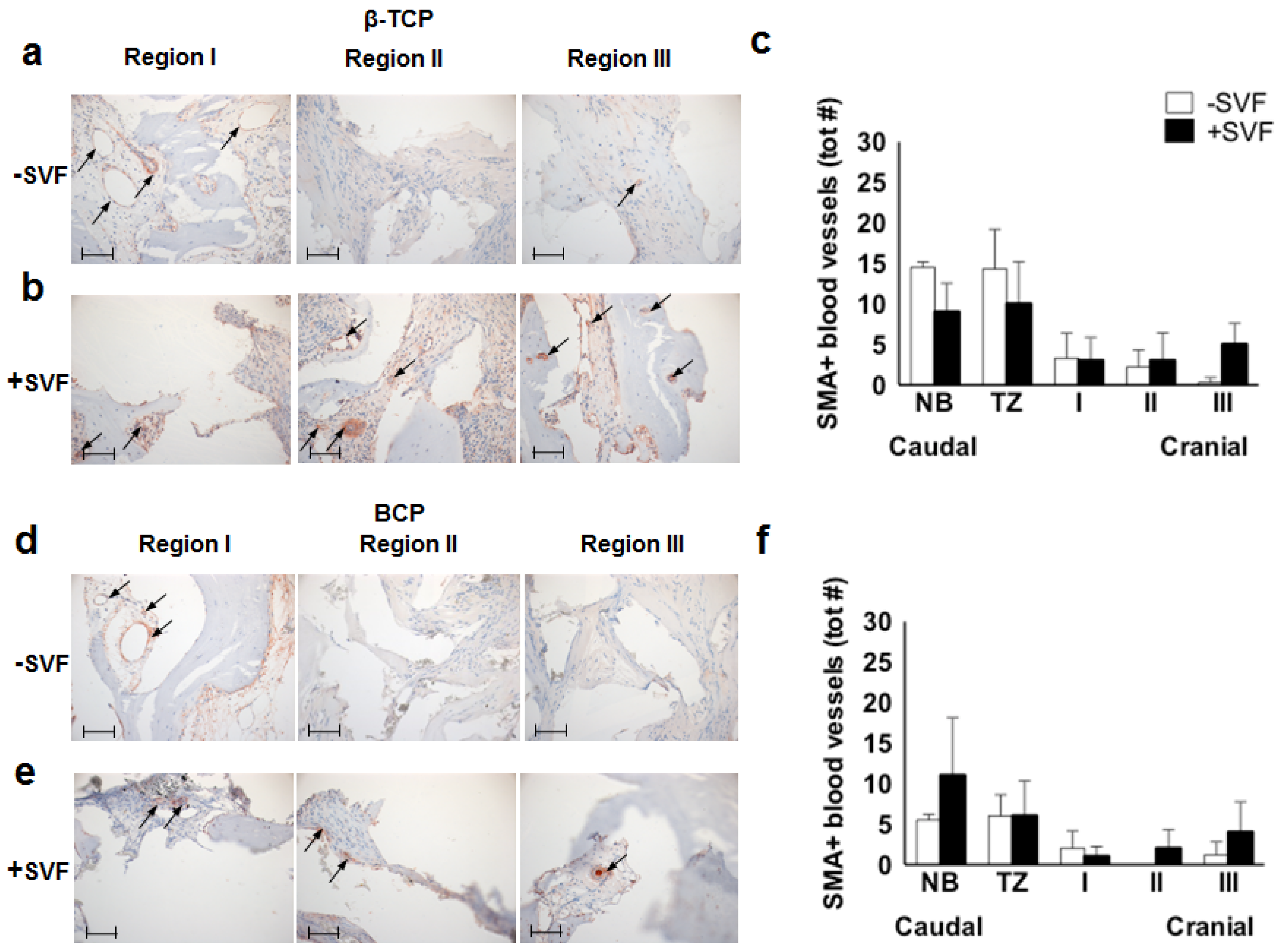 Materials 11 00161 g004