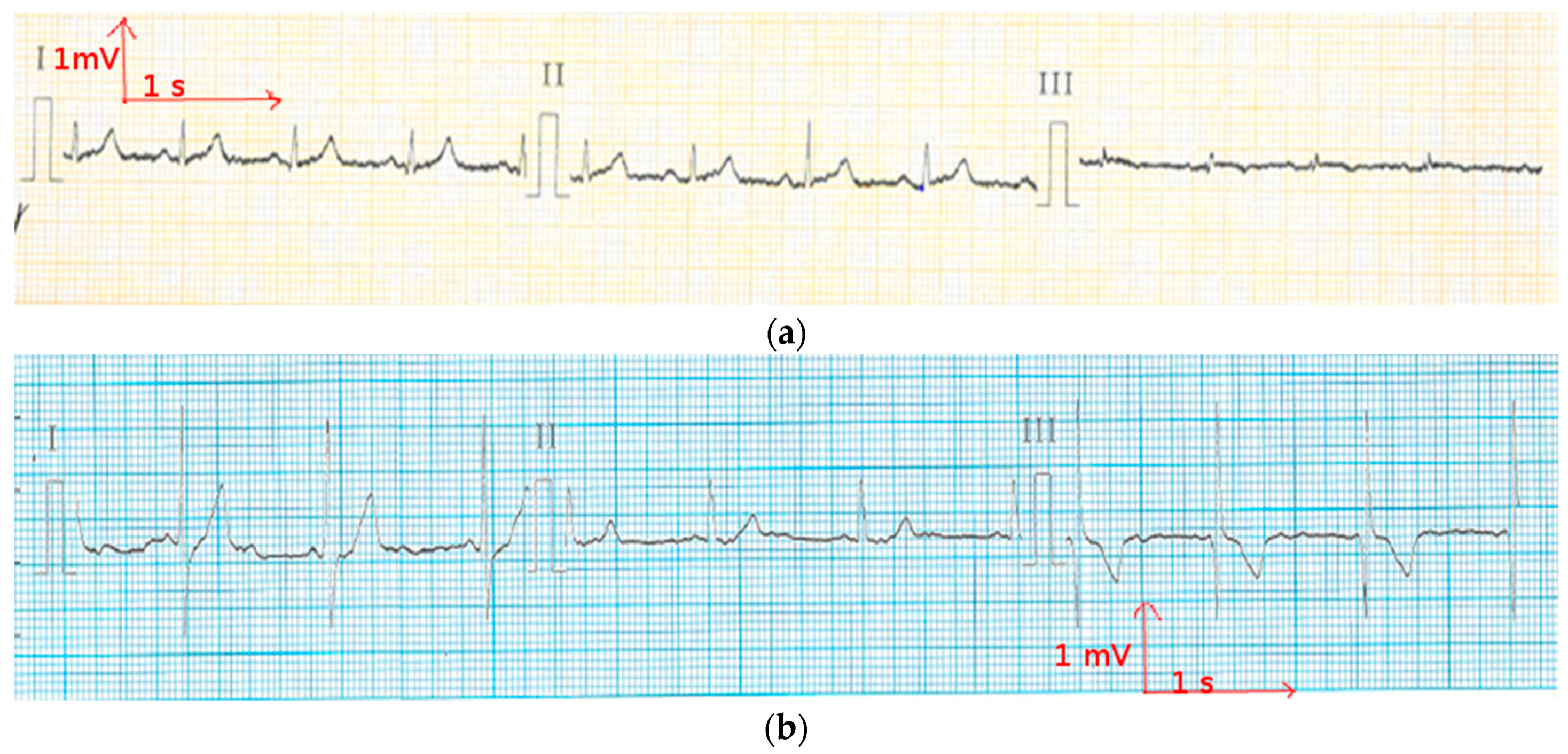 Materials 11 00256 g005