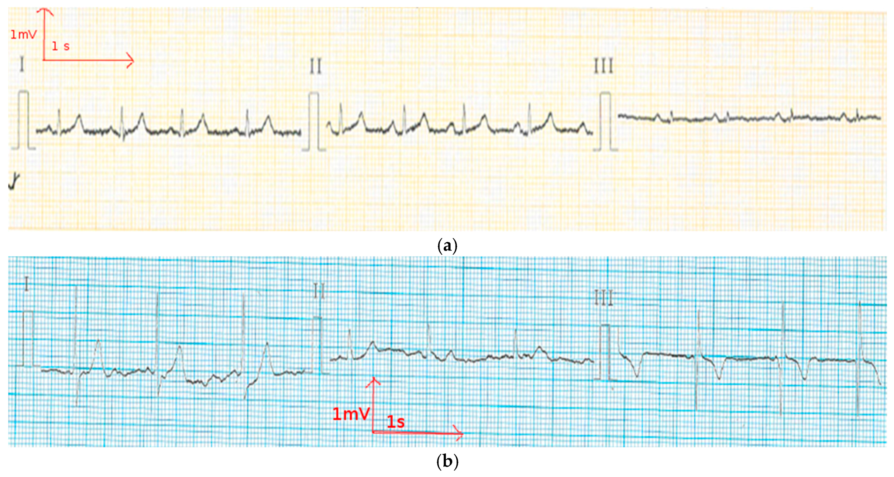 Materials 11 00256 g006