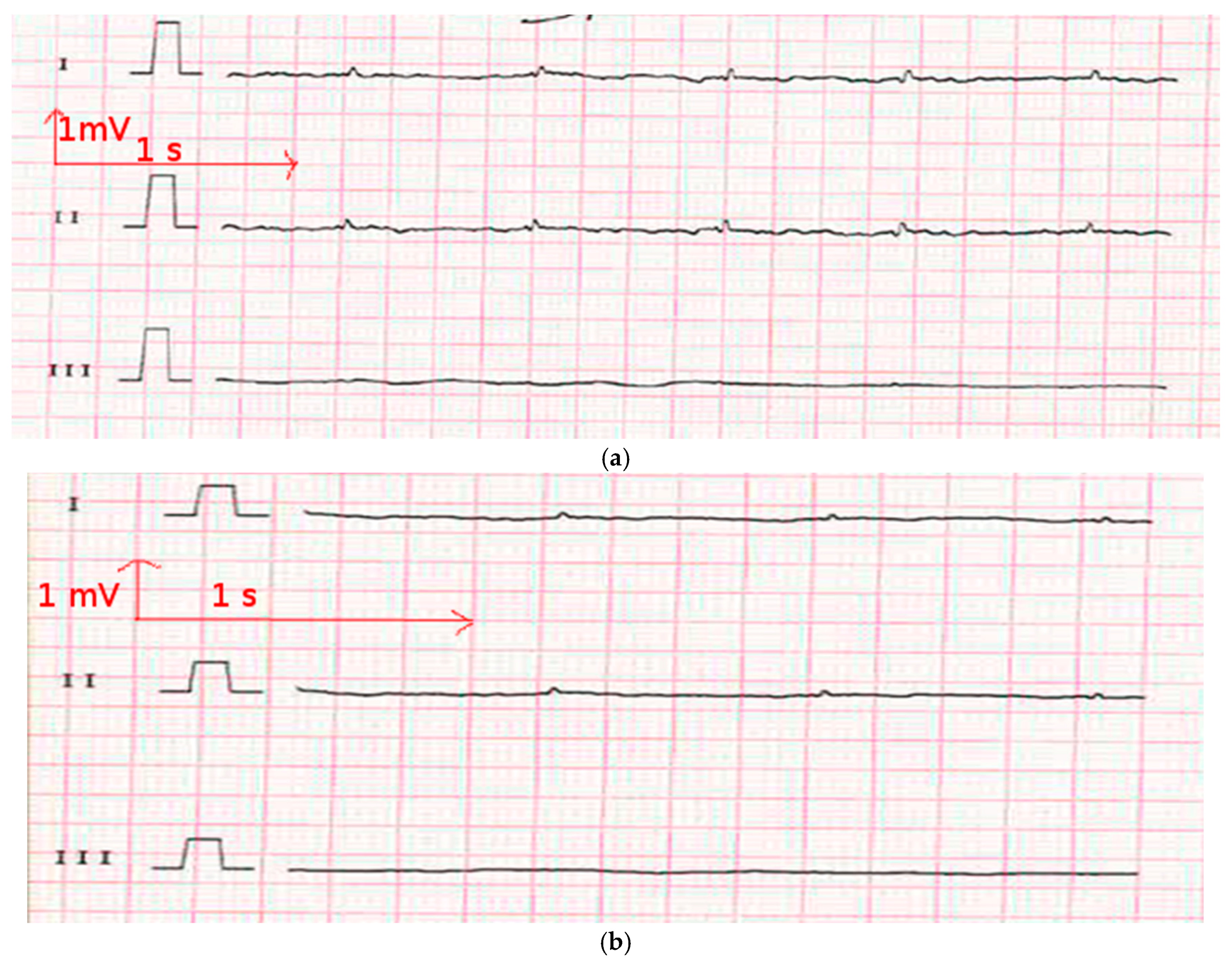 Materials 11 00256 g007