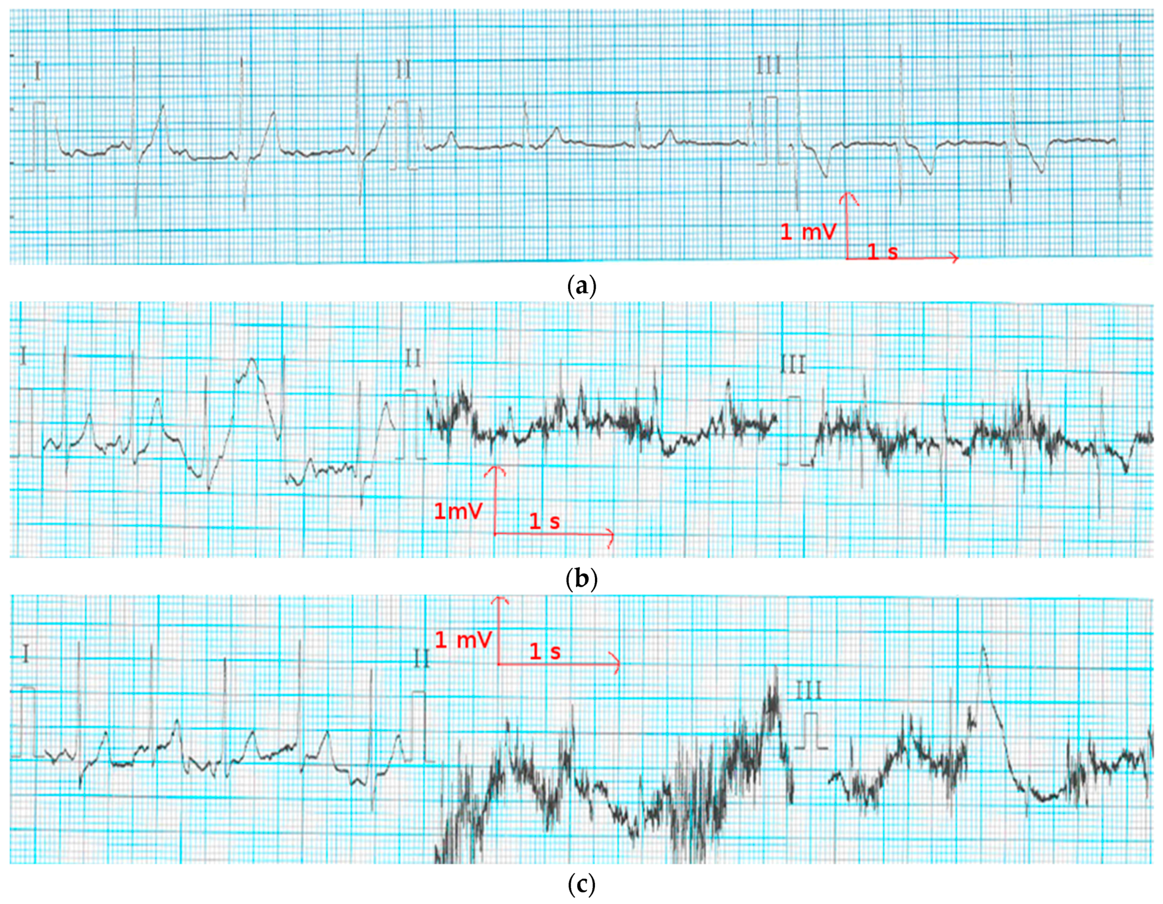 Materials 11 00256 g008