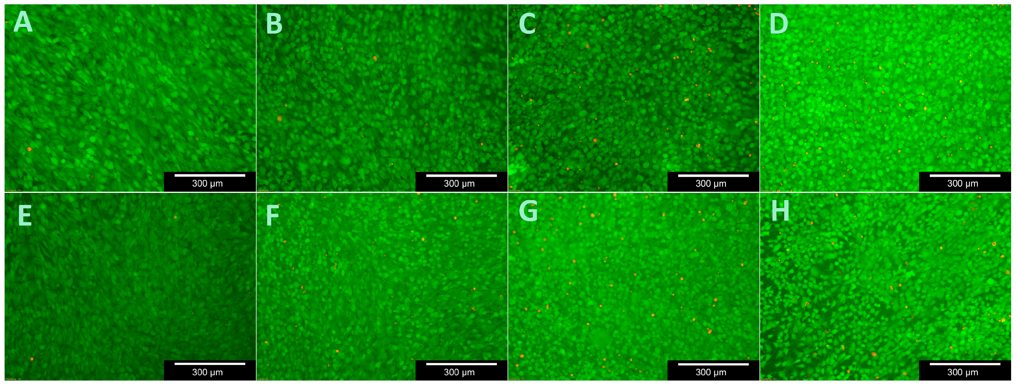 Materials 11 00316 g007