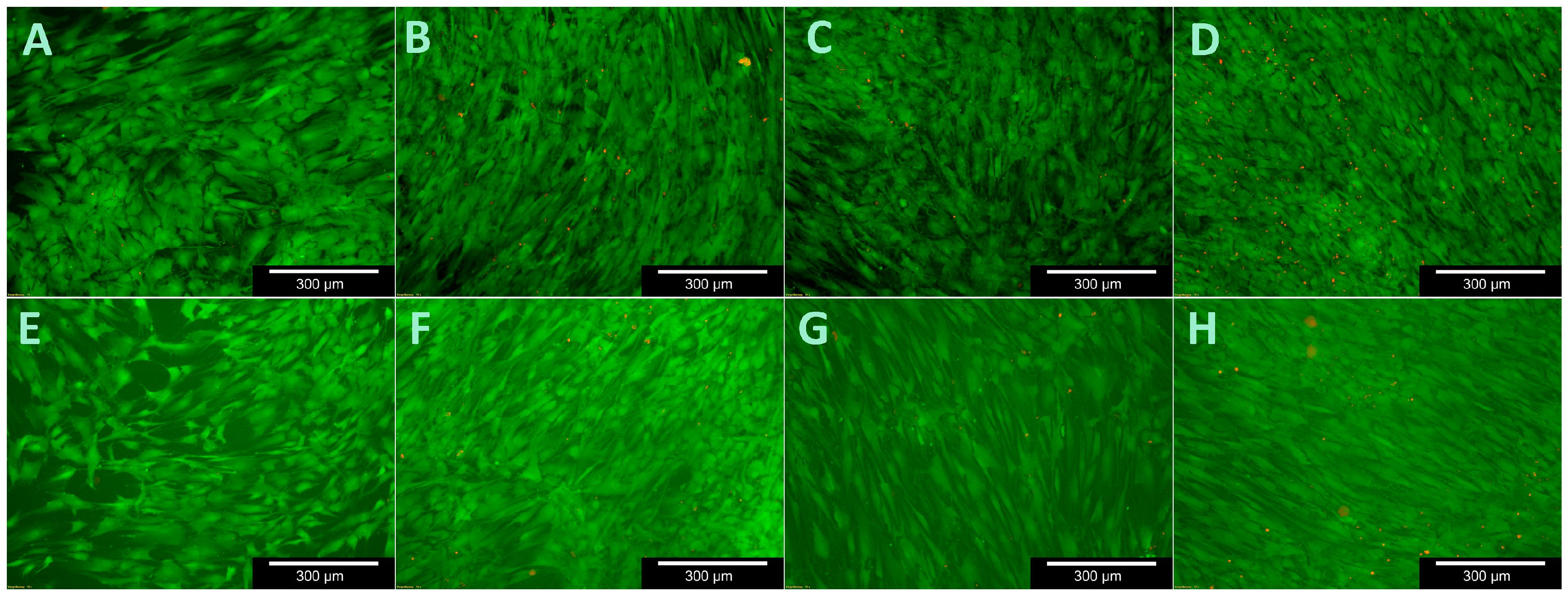 Materials 11 00316 g009