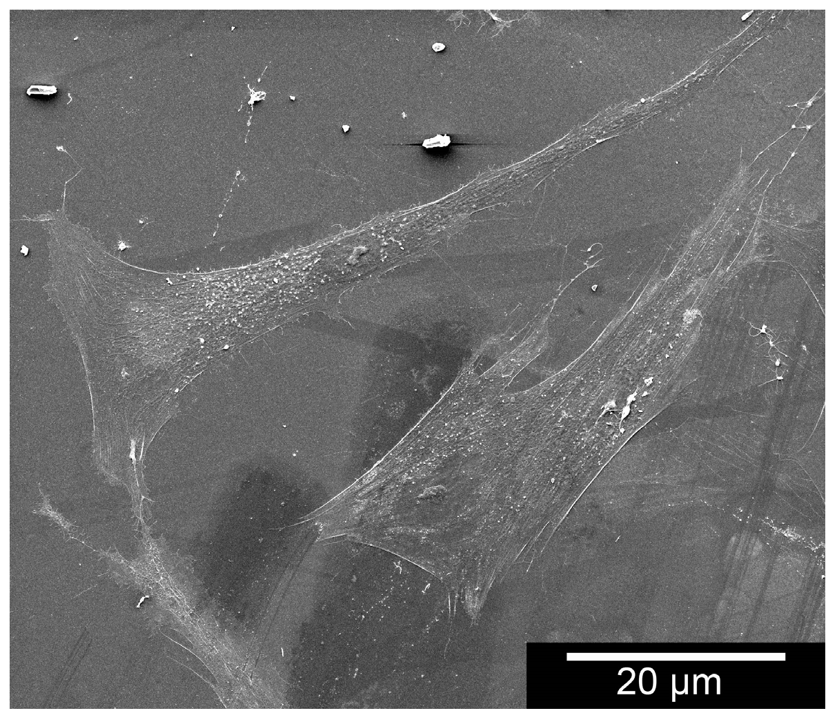 Materials 11 00316 g011