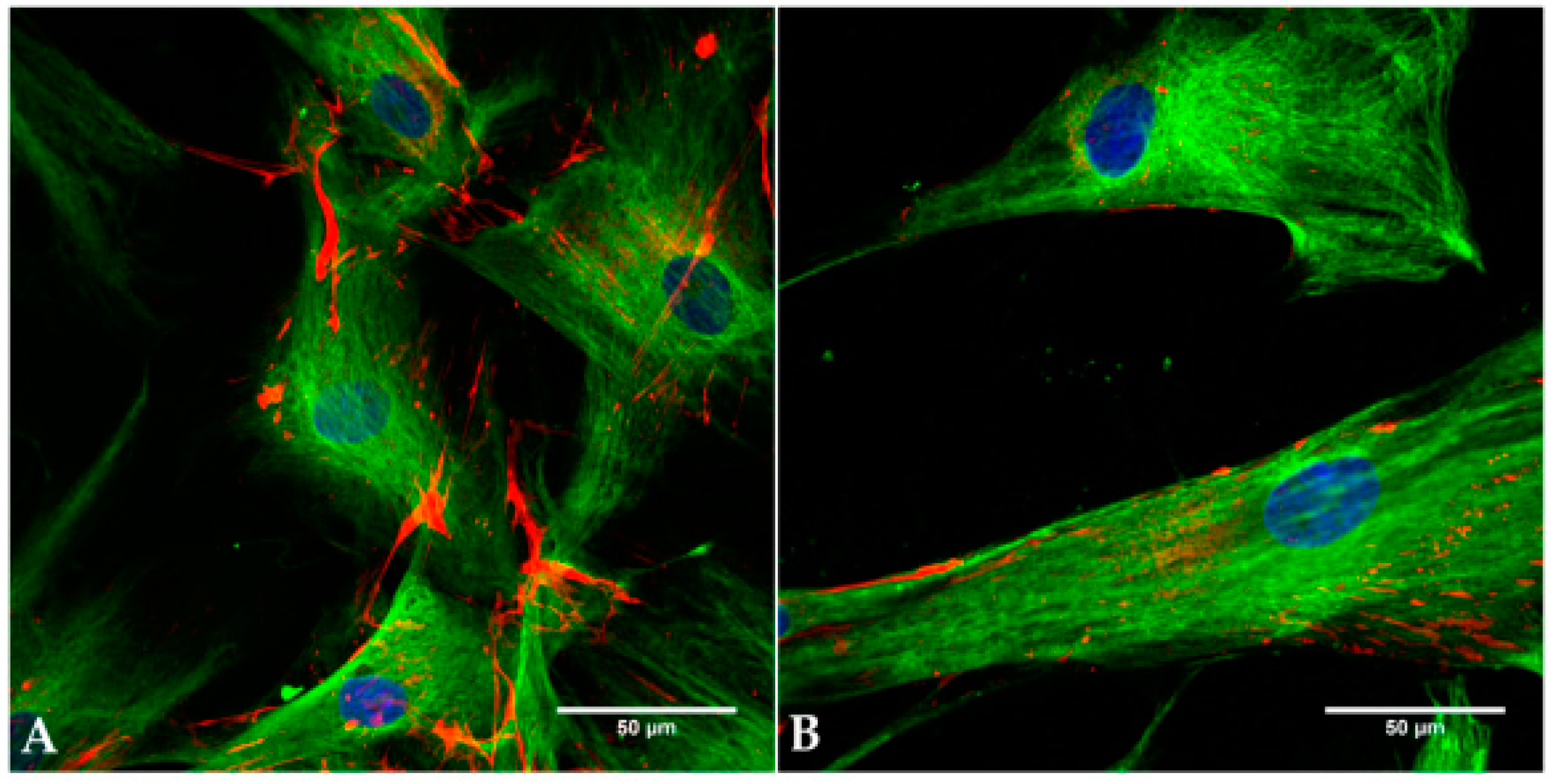 Materials 11 00341 g002