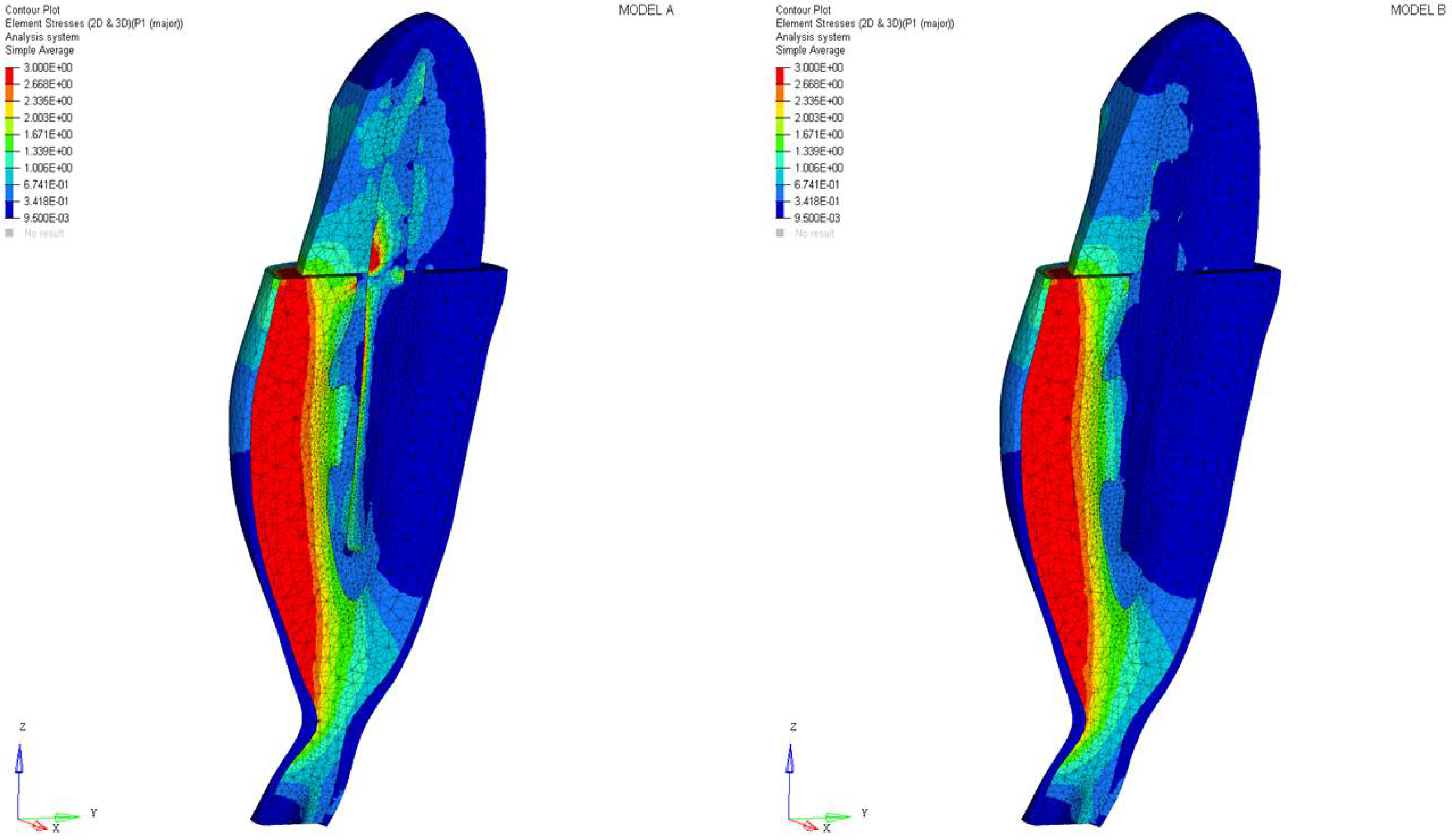 Materials 11 00738 g002