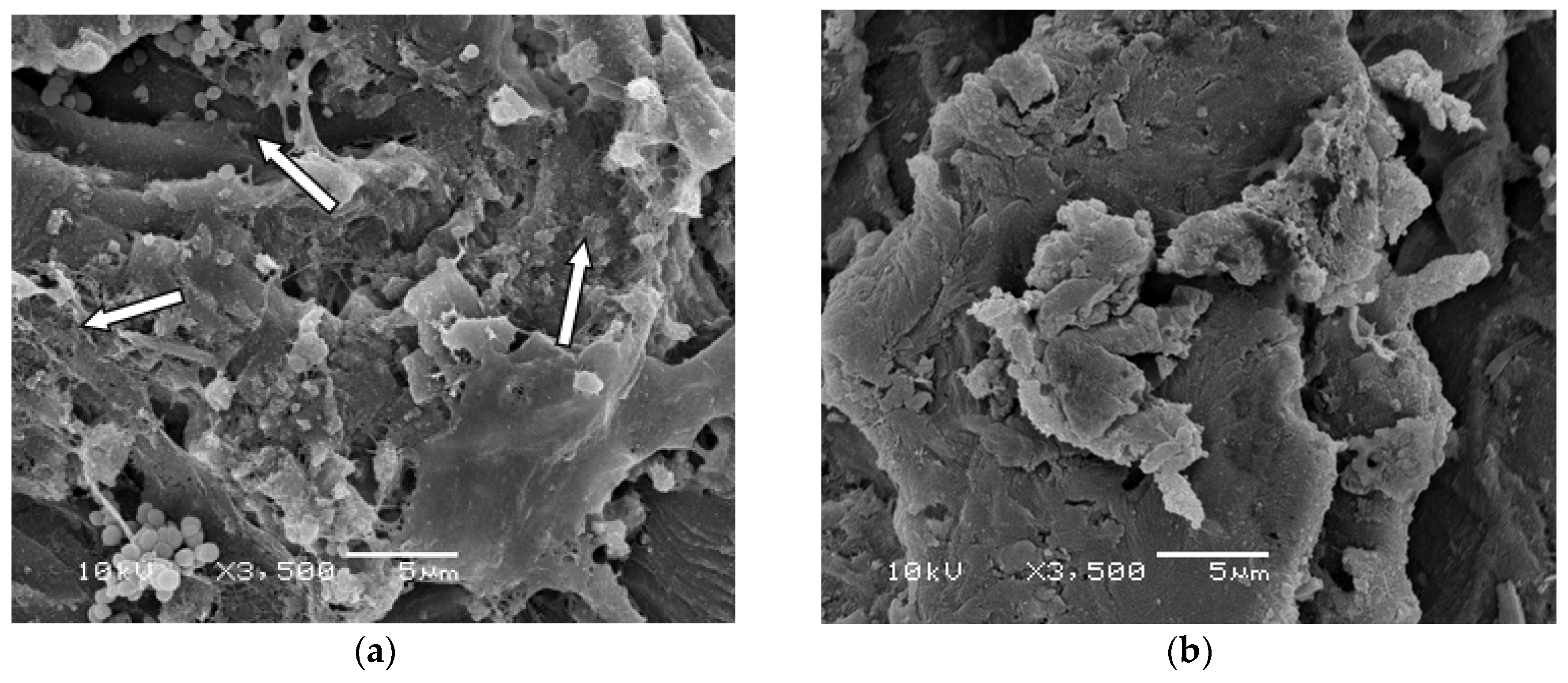 Materials 11 00811 g004a