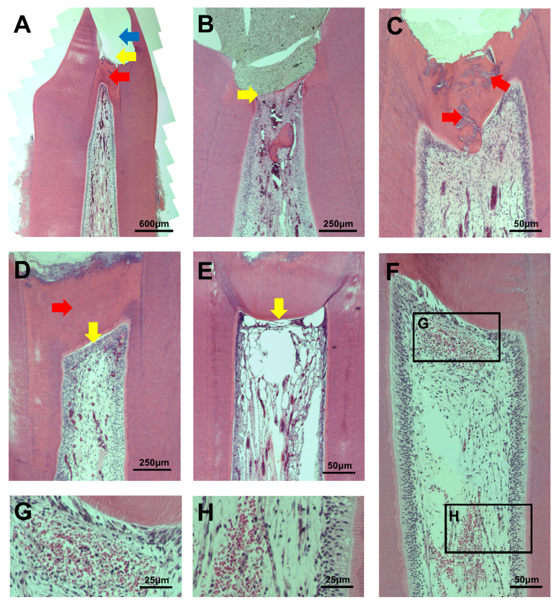 Materials 11 00899 g002