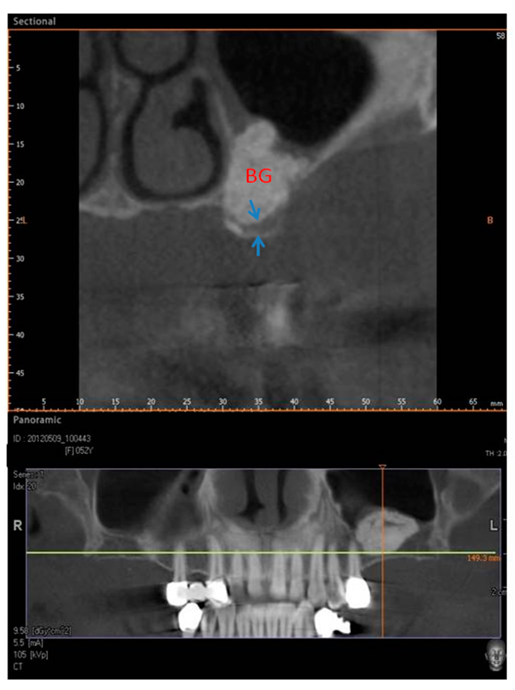 Materials 11 01457 g003