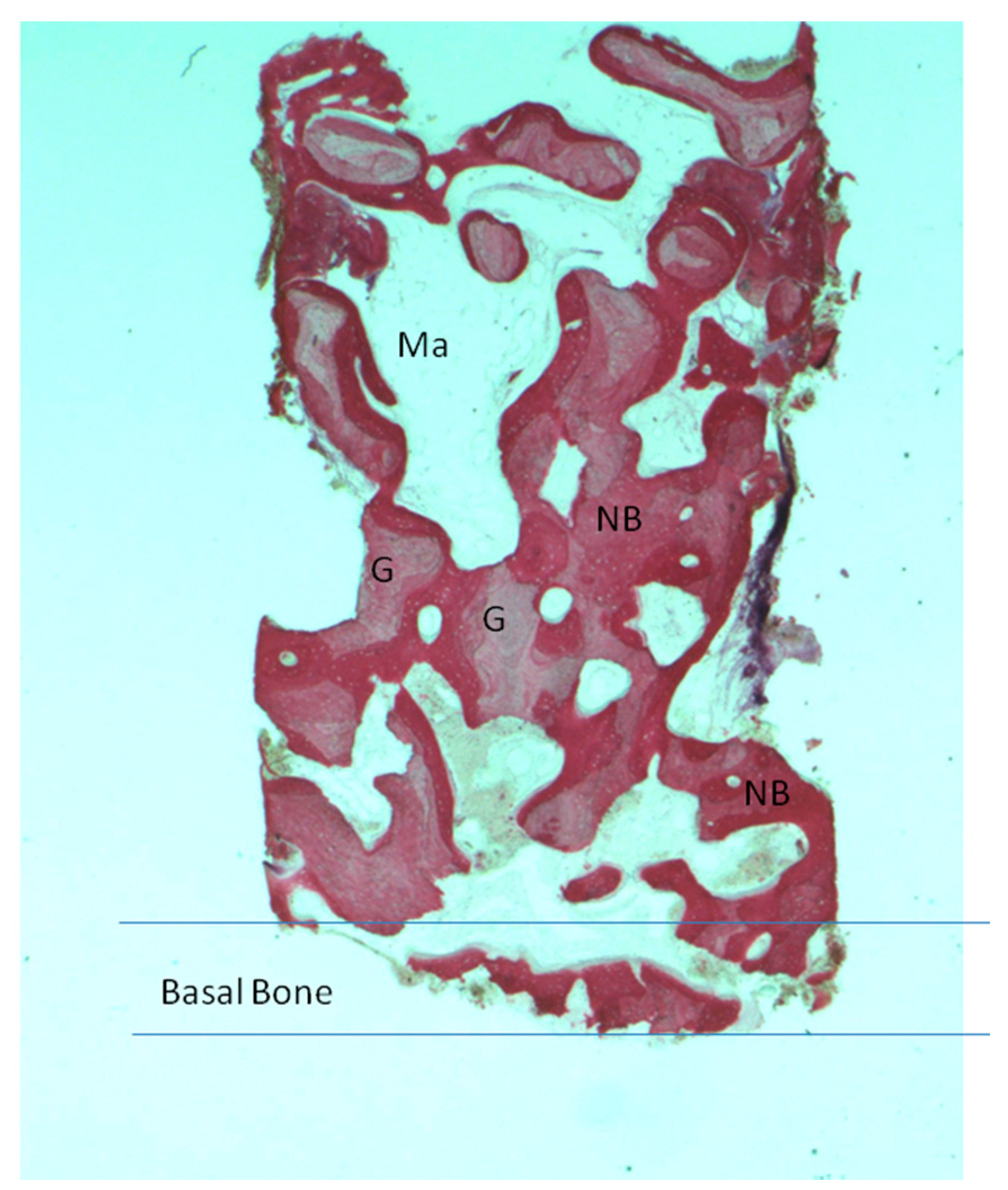 Materials 11 01457 g004