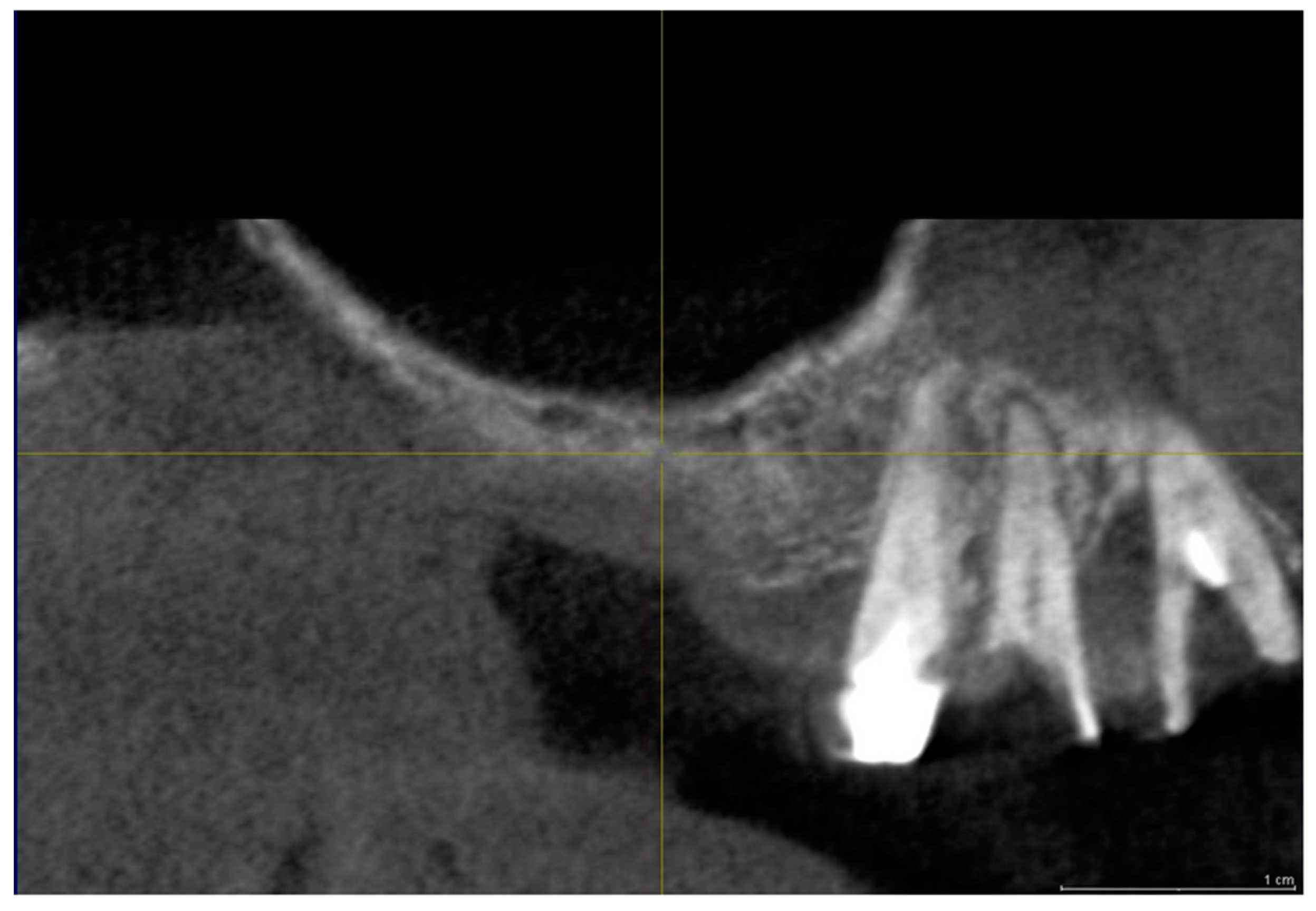 Materials 11 01457 g005