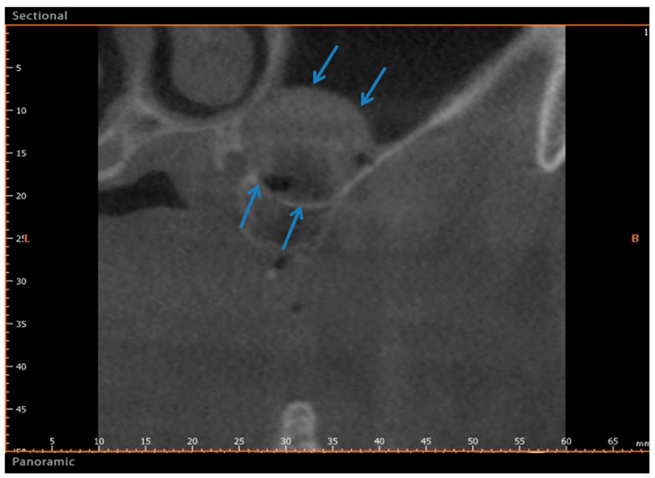 Materials 11 01457 g006