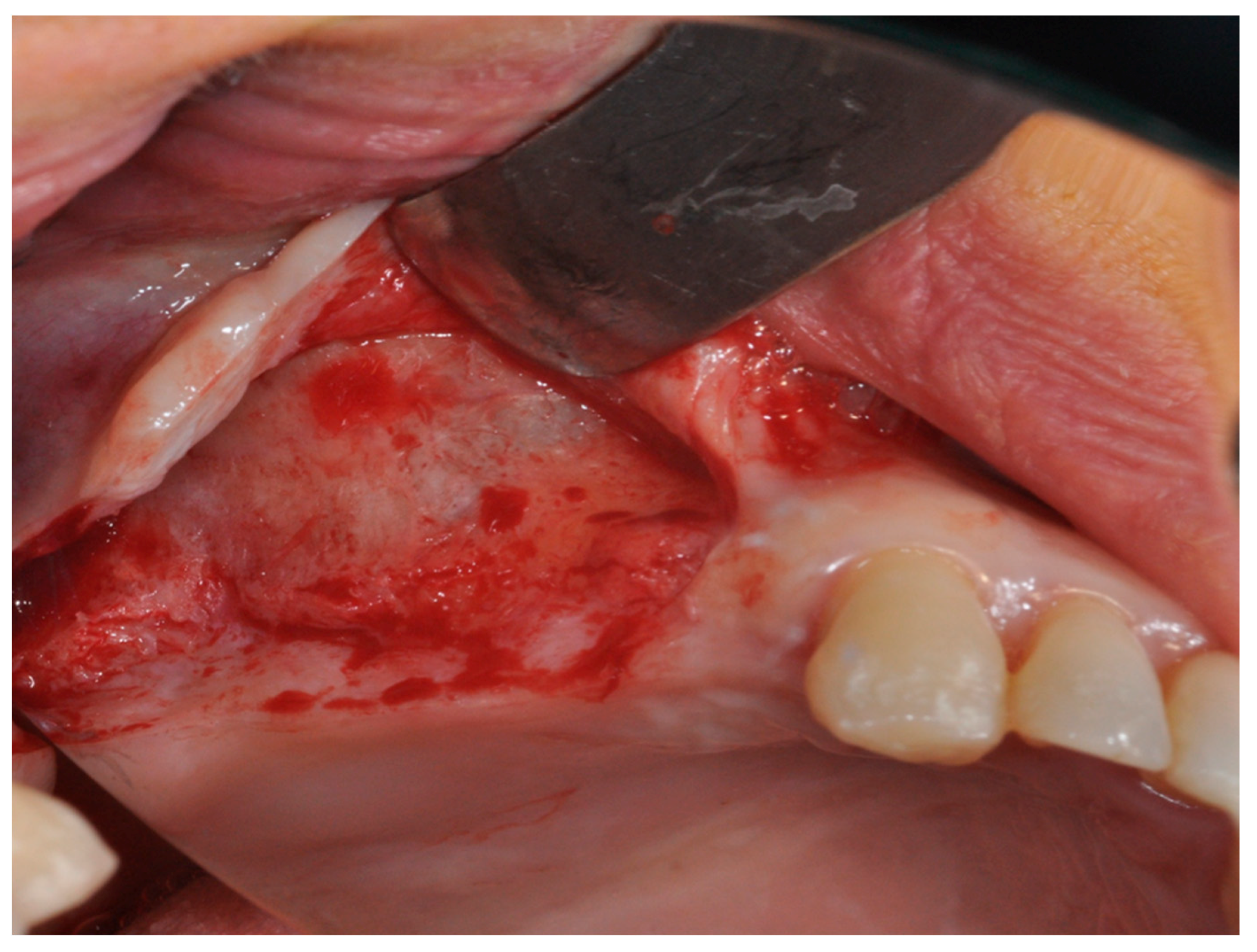 Materials 11 01457 g008