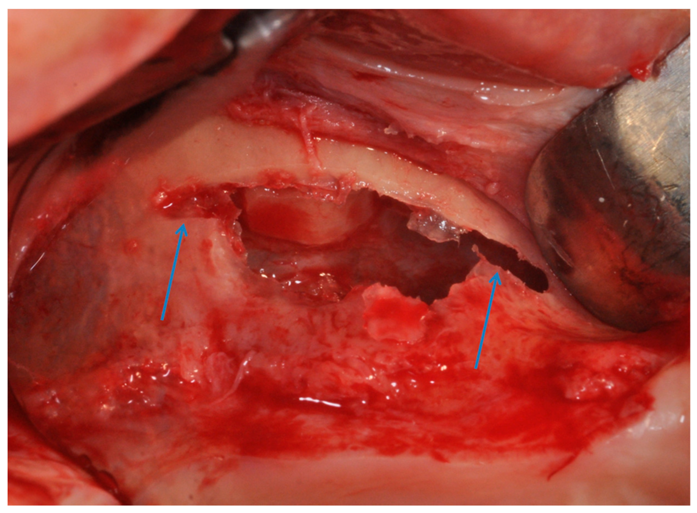 Materials 11 01457 g009