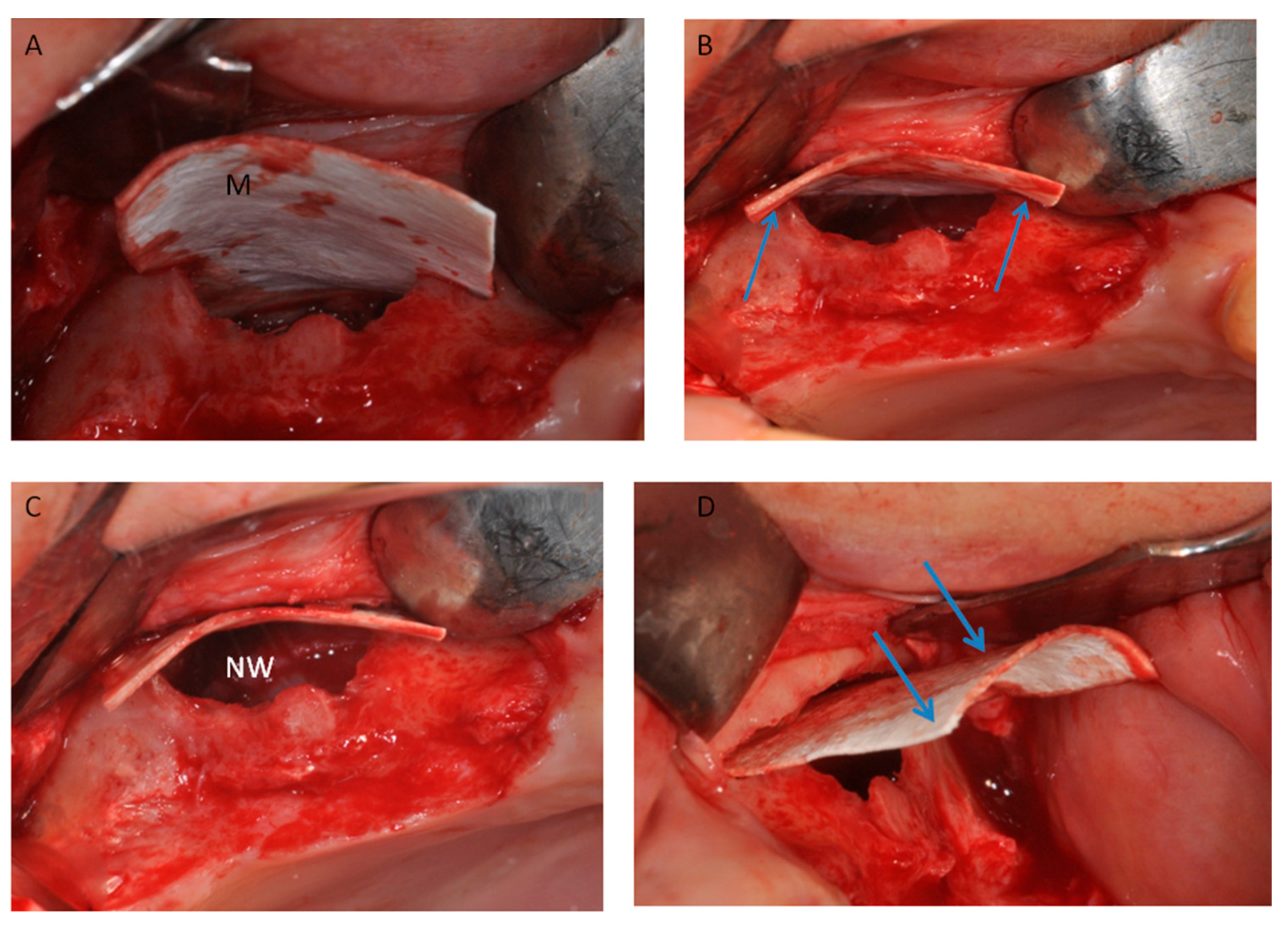 Materials 11 01457 g010