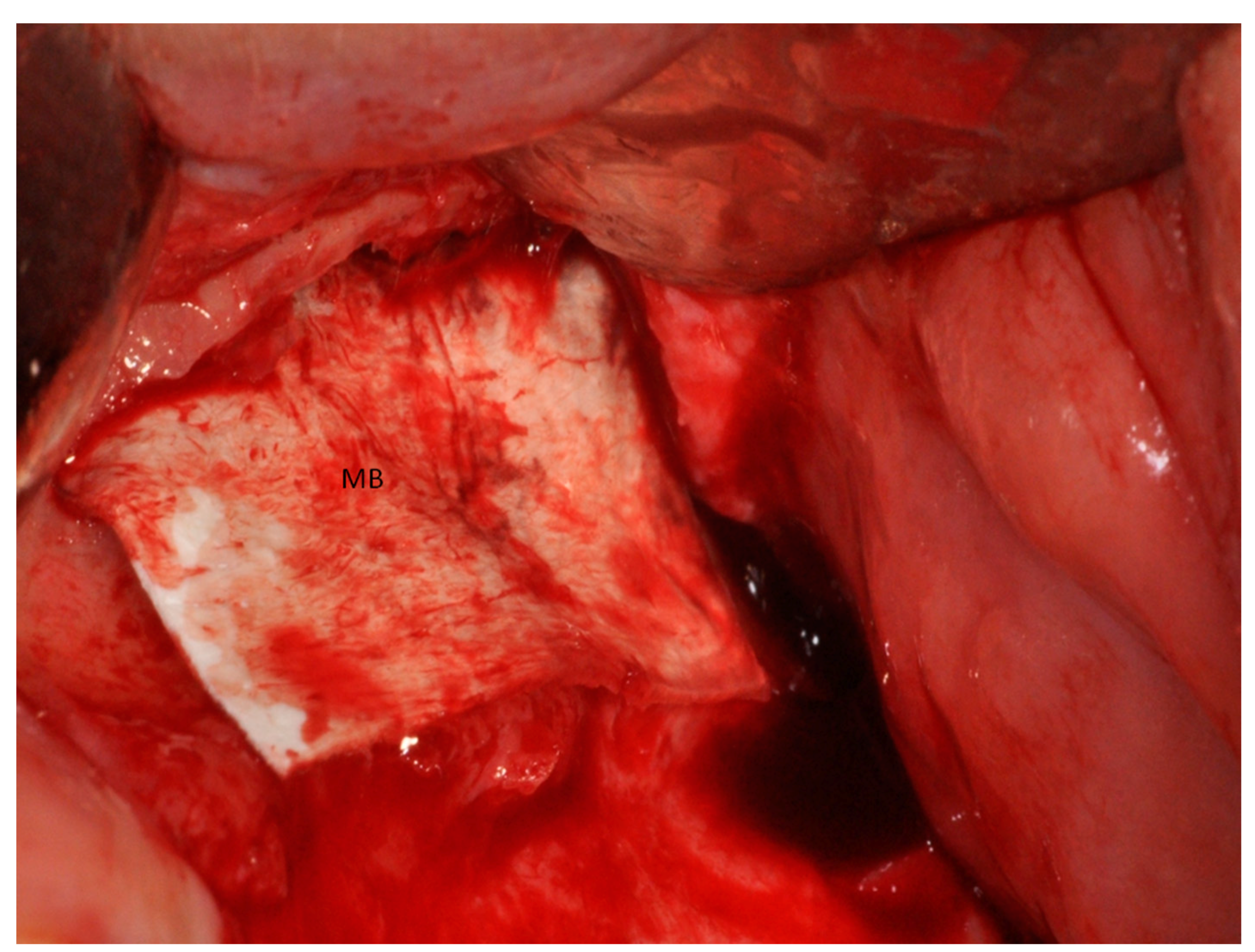 Materials 11 01457 g011