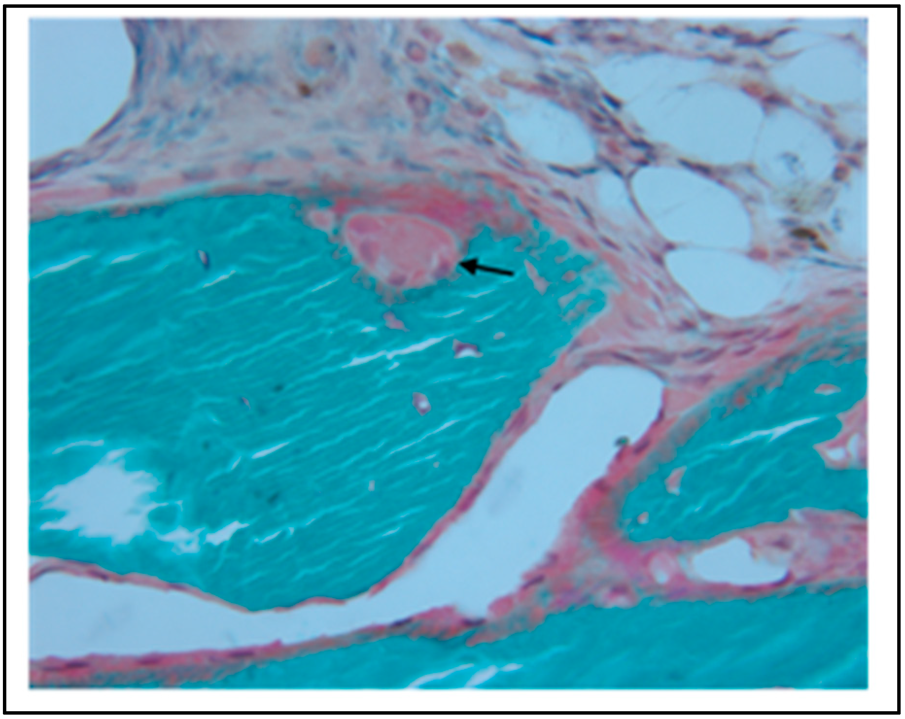 Materials 11 01556 g012