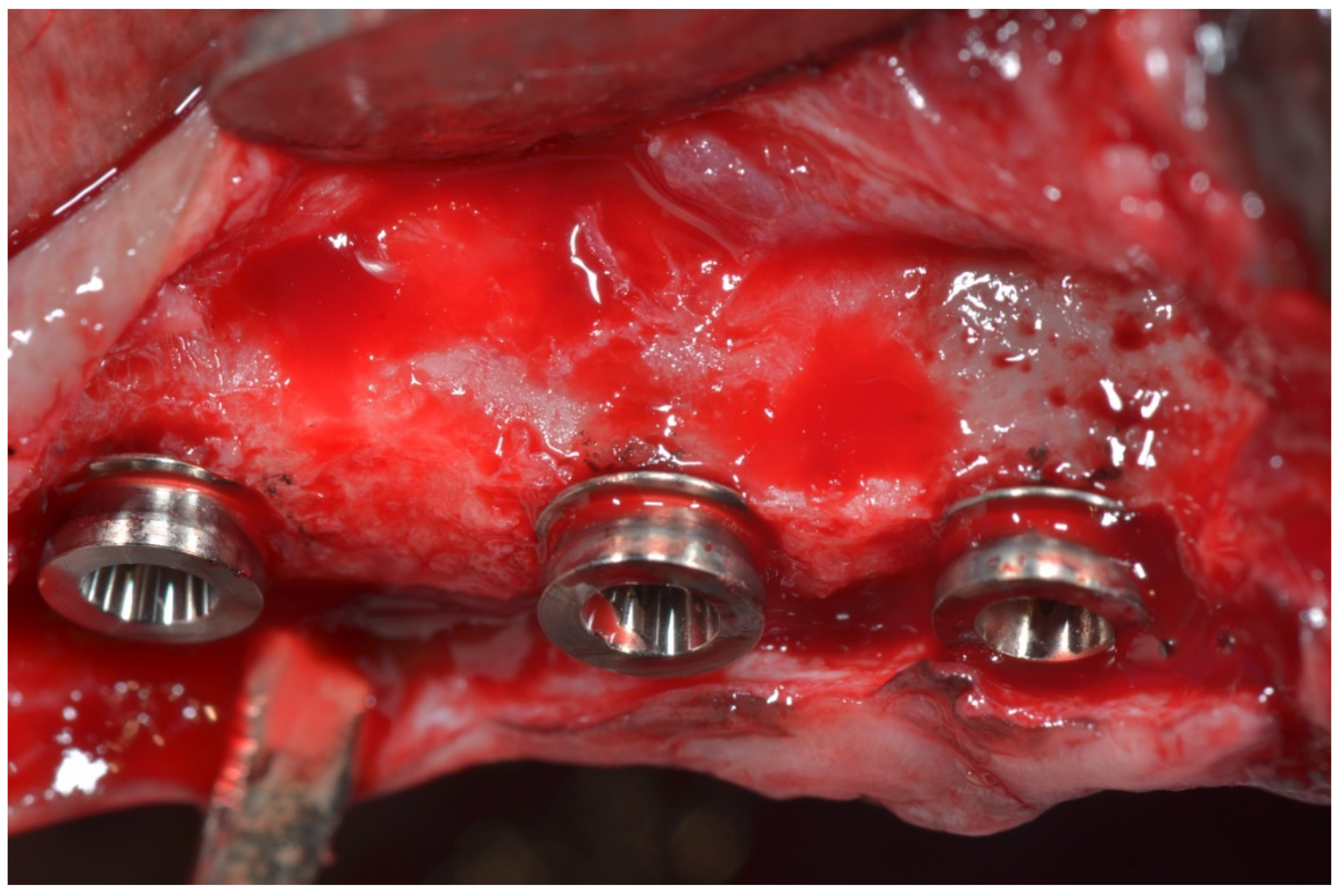 Materials 11 01630 g003 Materials 11 01630 g003