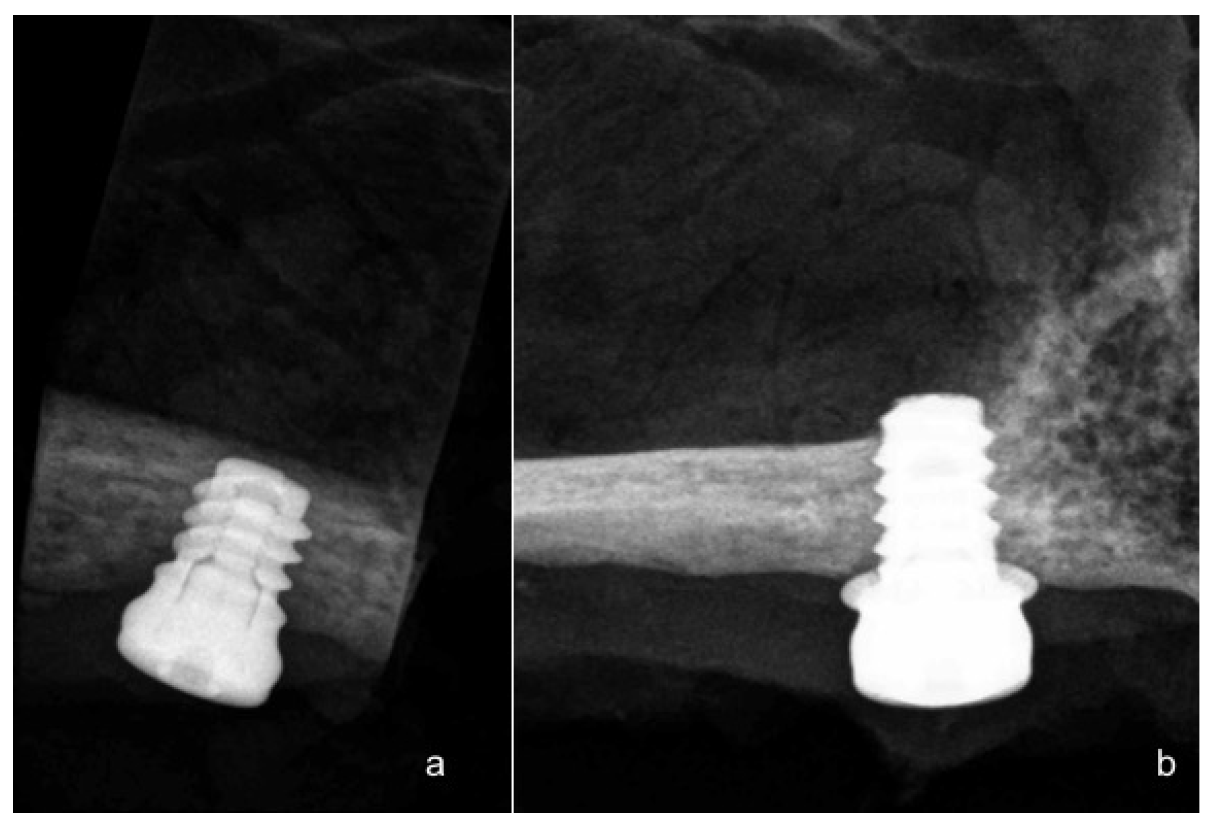 Materials 11 01630 g004 Materials 11 01630 g004