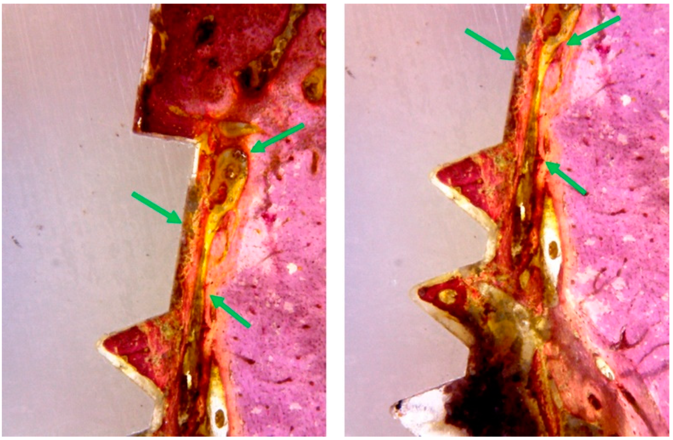 Materials 12 00856 g009