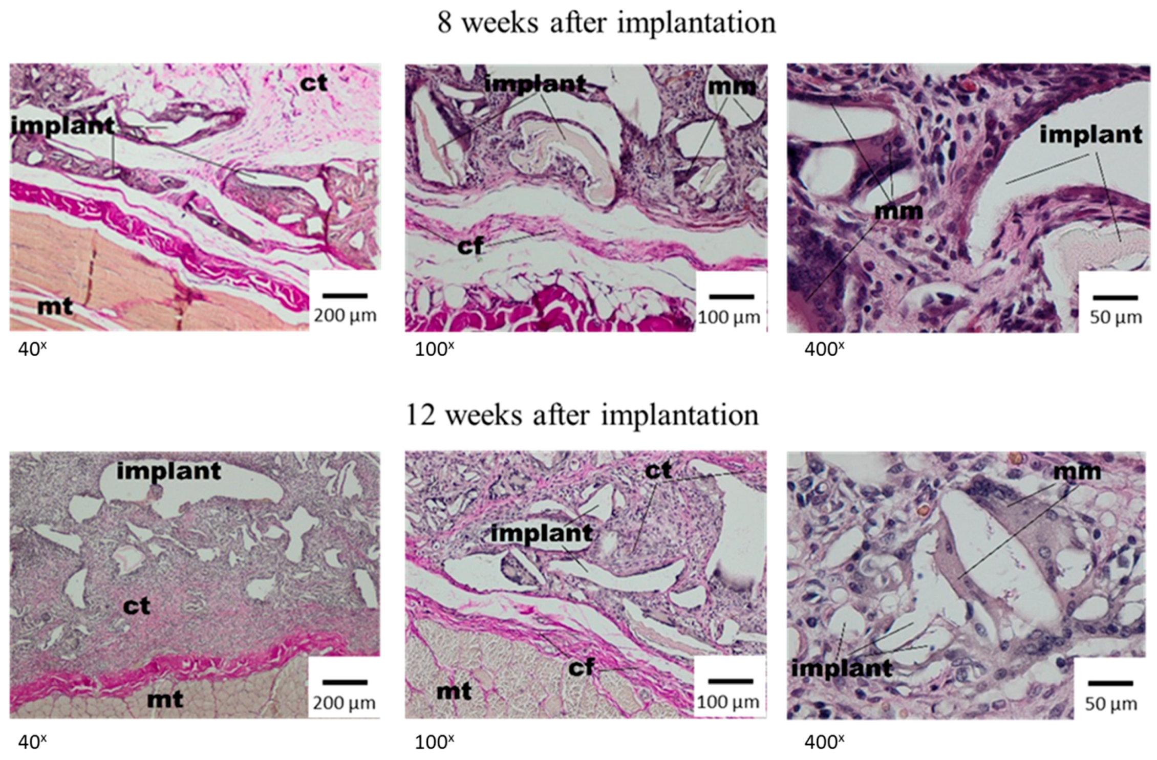 Materials 12 00970 g004